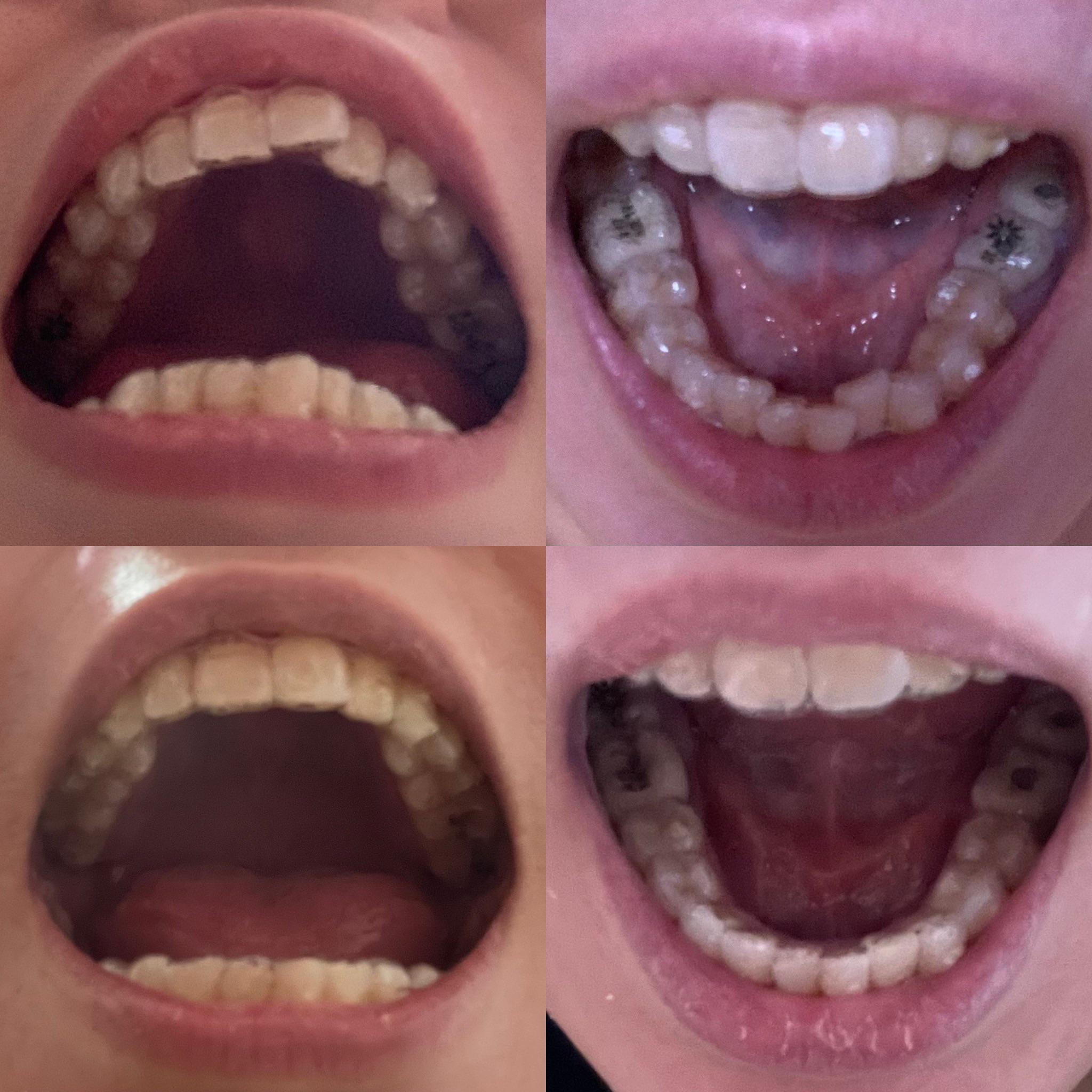 Thought I’ll share this for encouragement... (pls ignore the dry lips