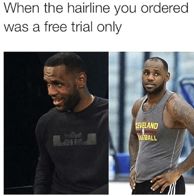 Best Hairline Jokes