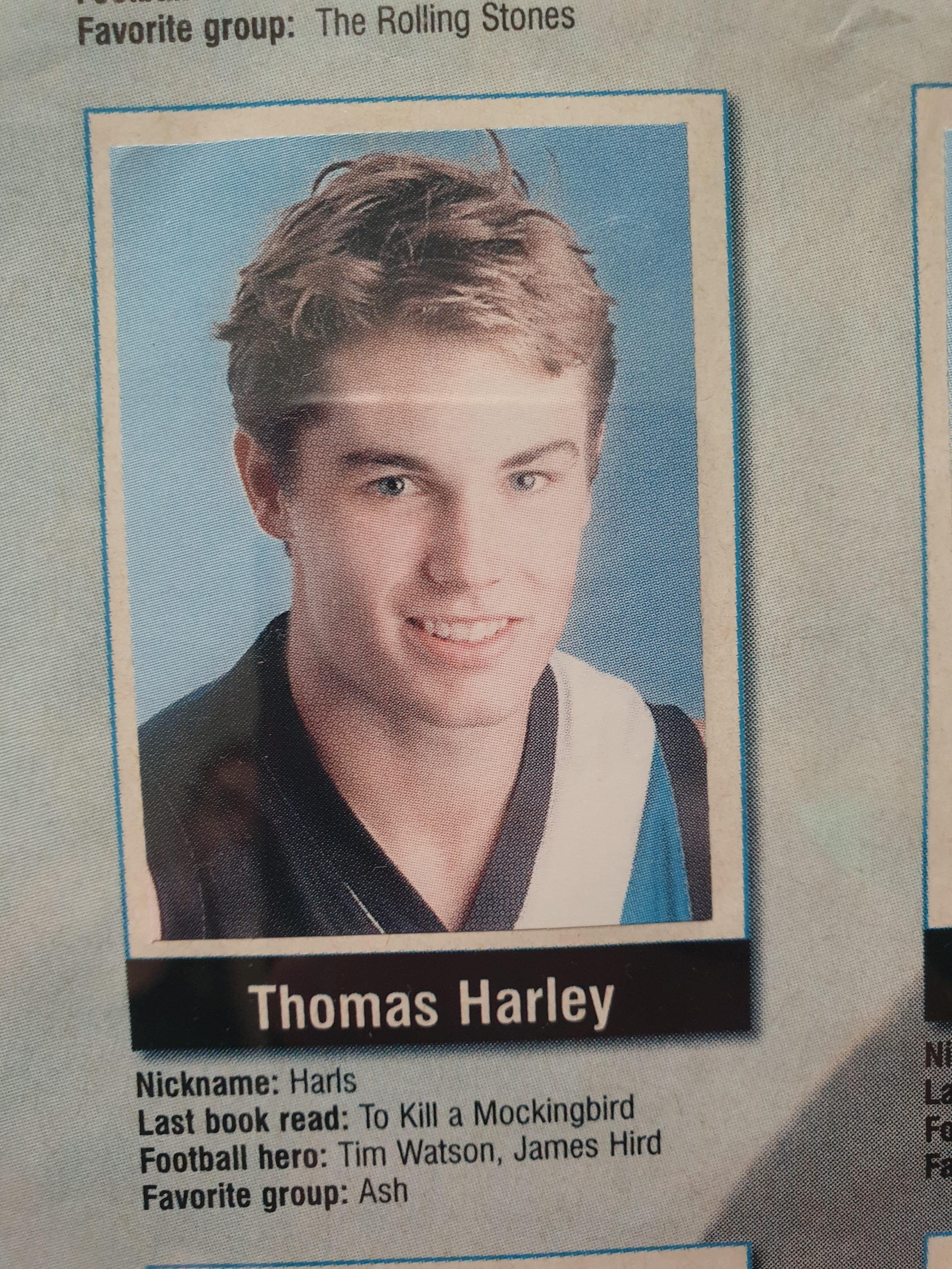 Guys that are bald now but had hair. Tom Harley AFL
