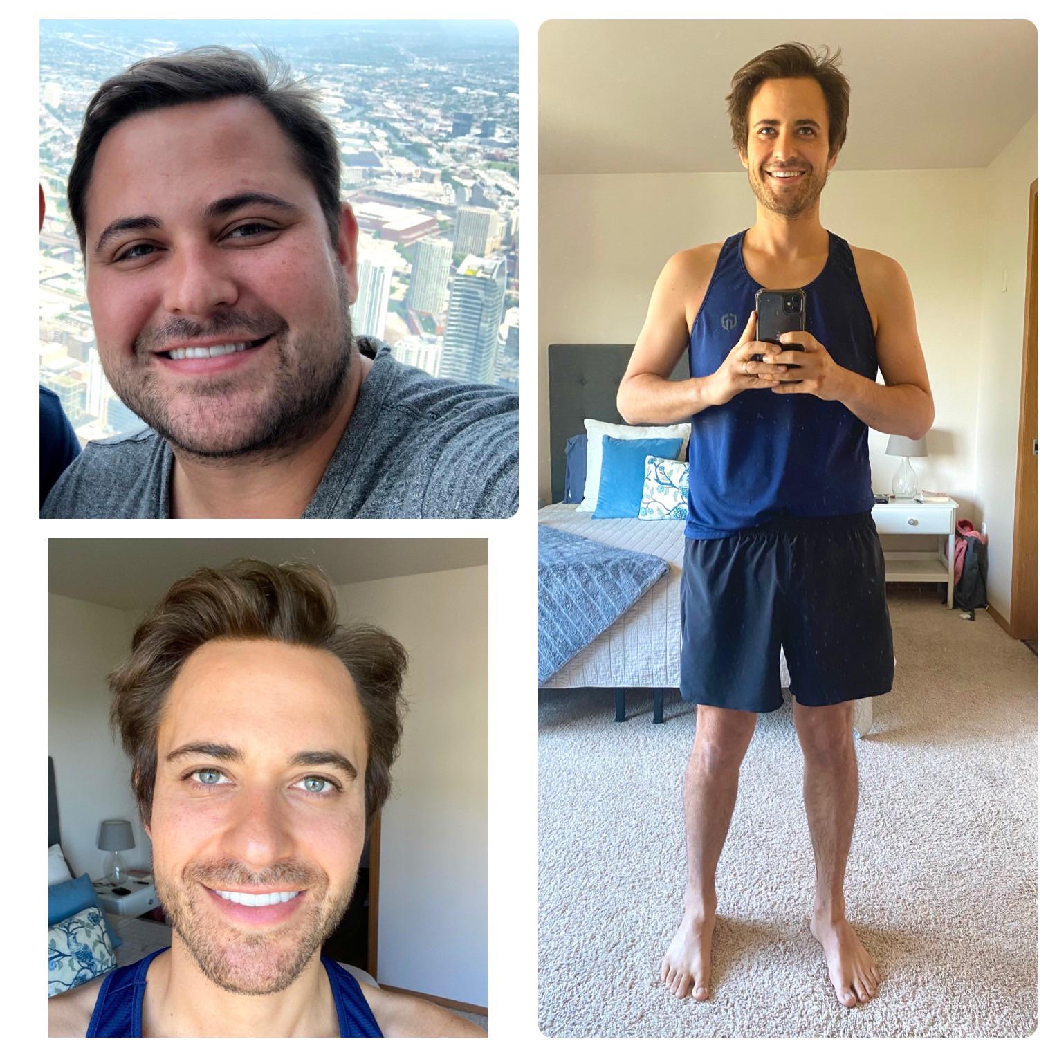 M/32/5’10” [282 lbs > 160 lbs = 122 lbs] (2.5 years) I achieved my goal