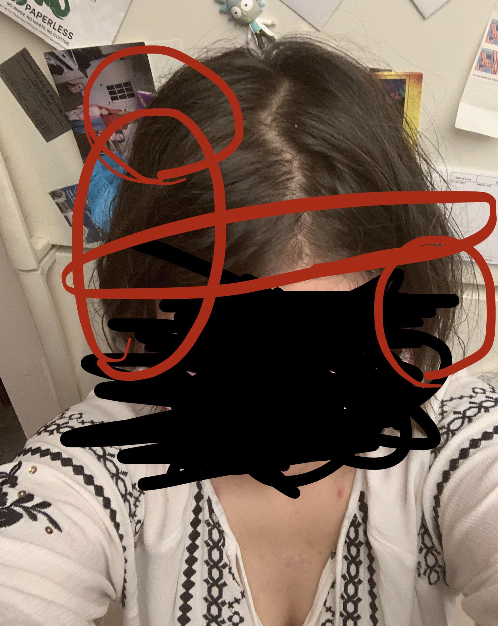 What causes pain/pressure in these areas? Normally I get ice pick