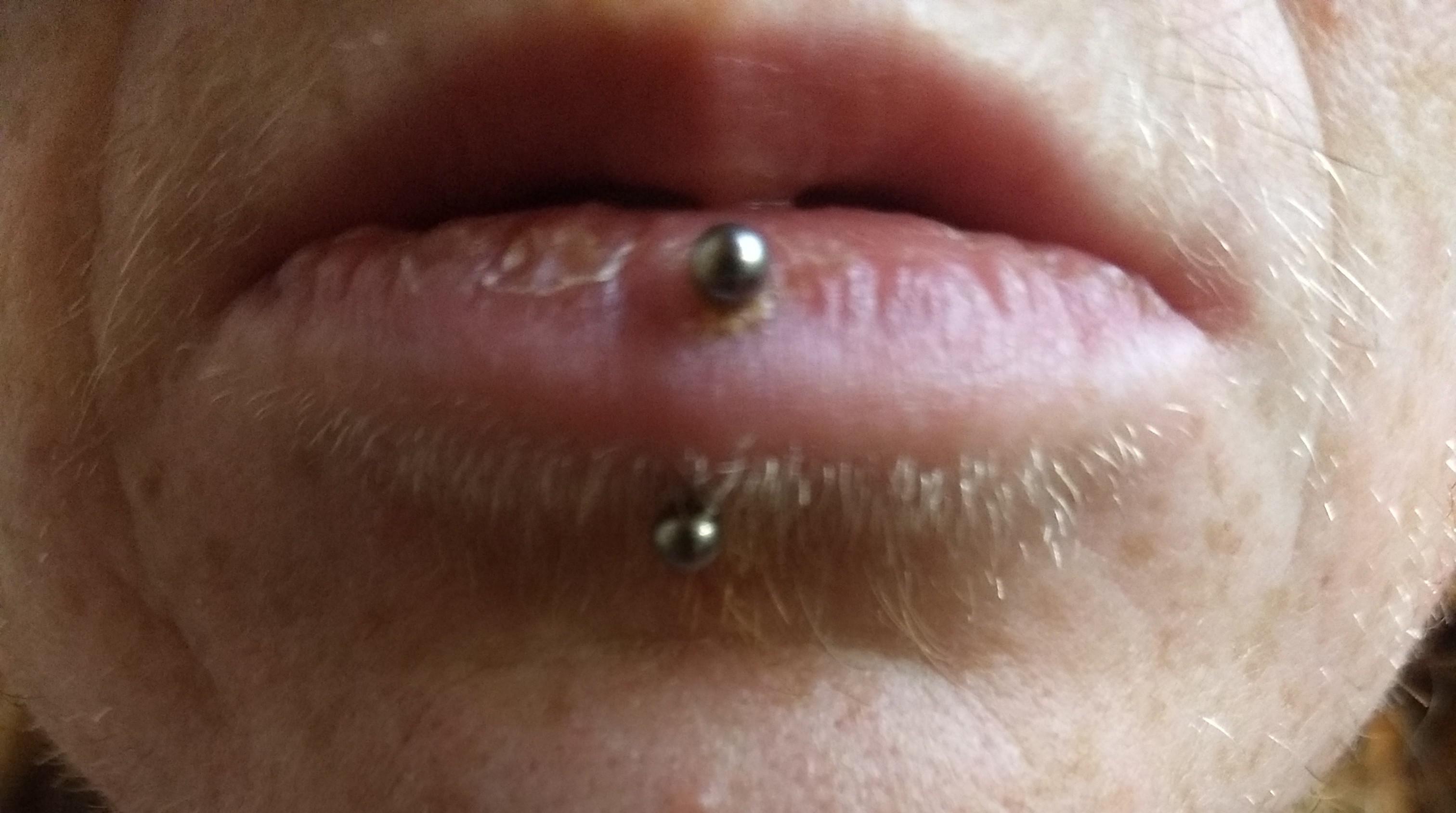 Lip Piercing Bump Inside Piercing It