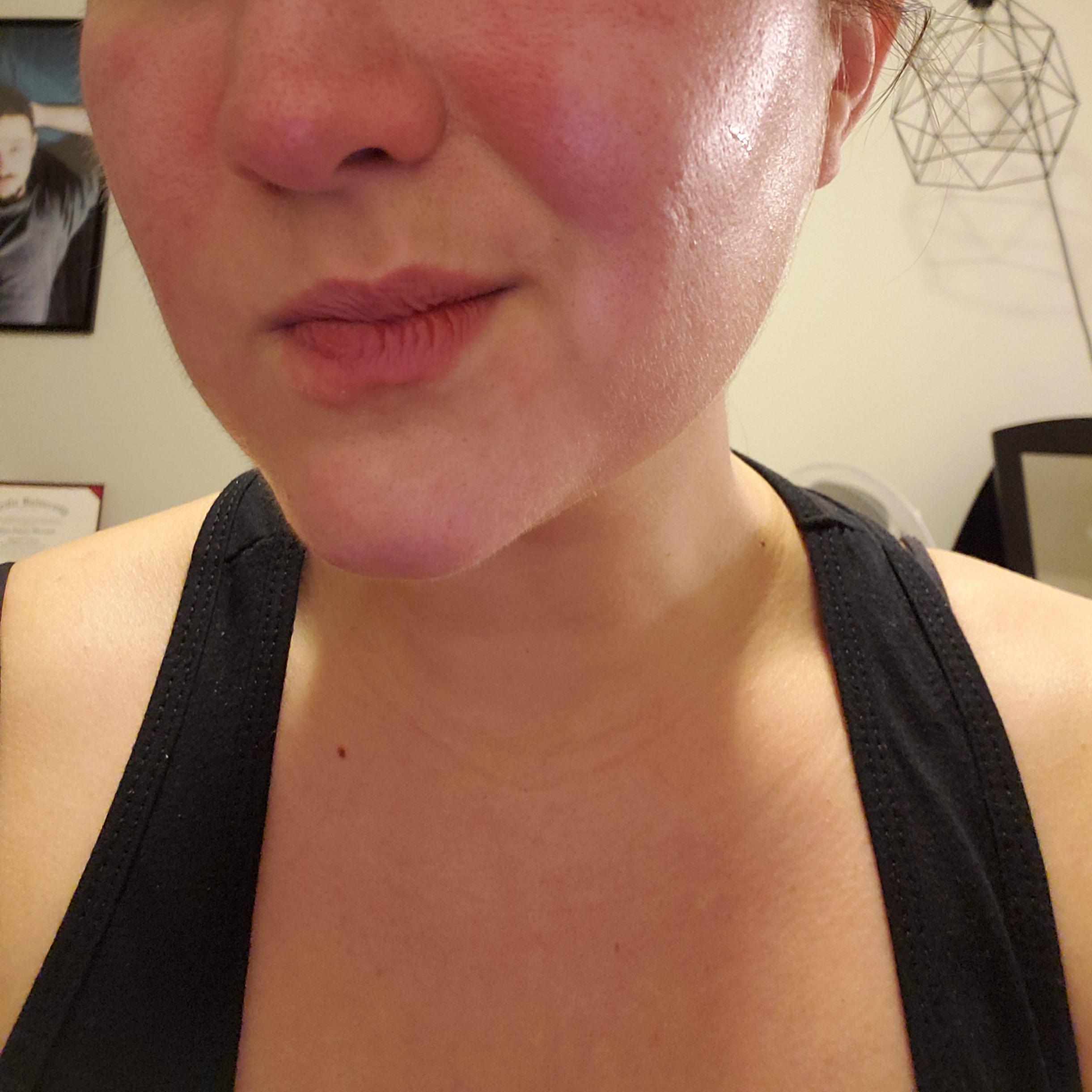 It burns! How do you calm the face fire? Previously fine face lotion is