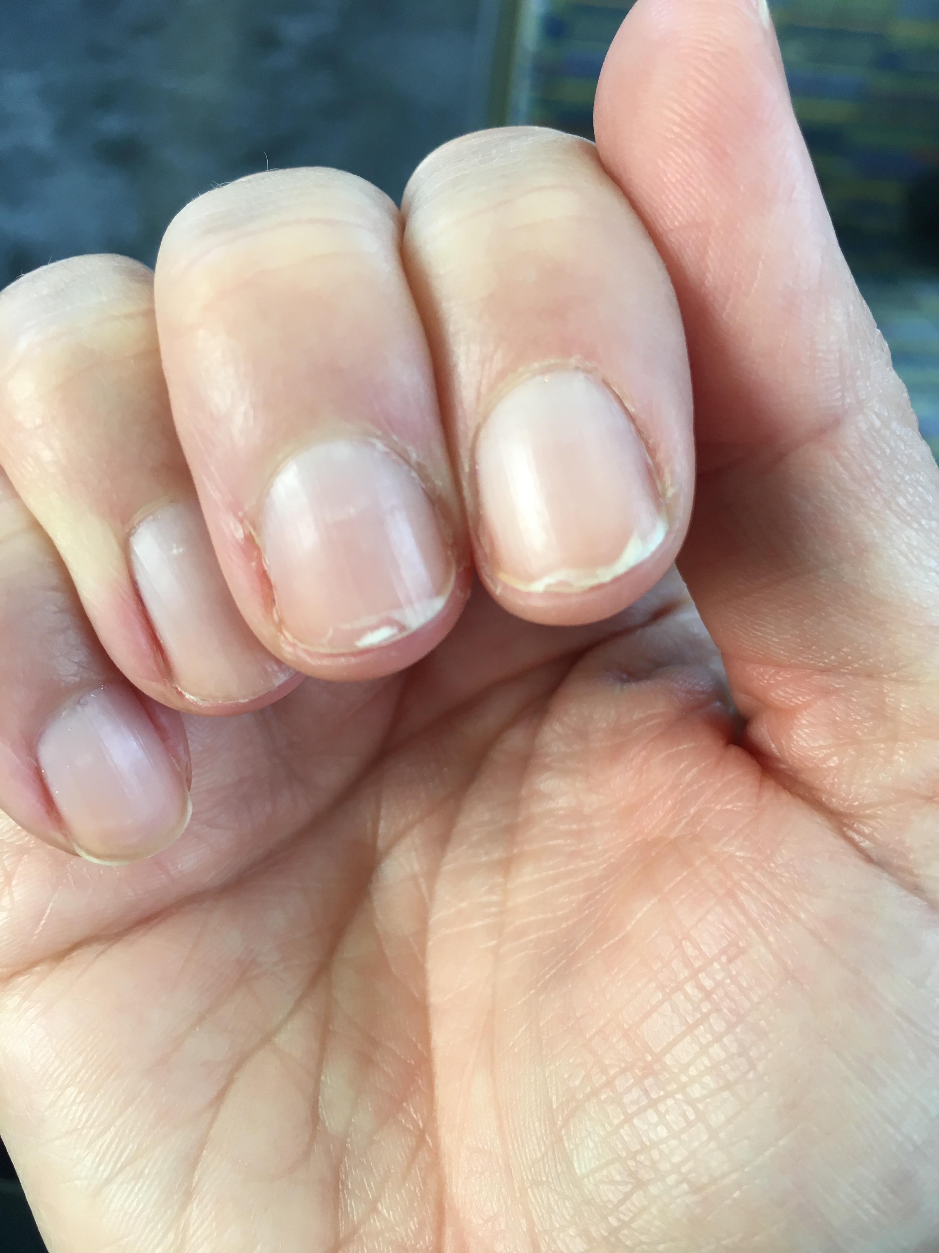 Despite my best efforts (oil, careful filing, good quality polish