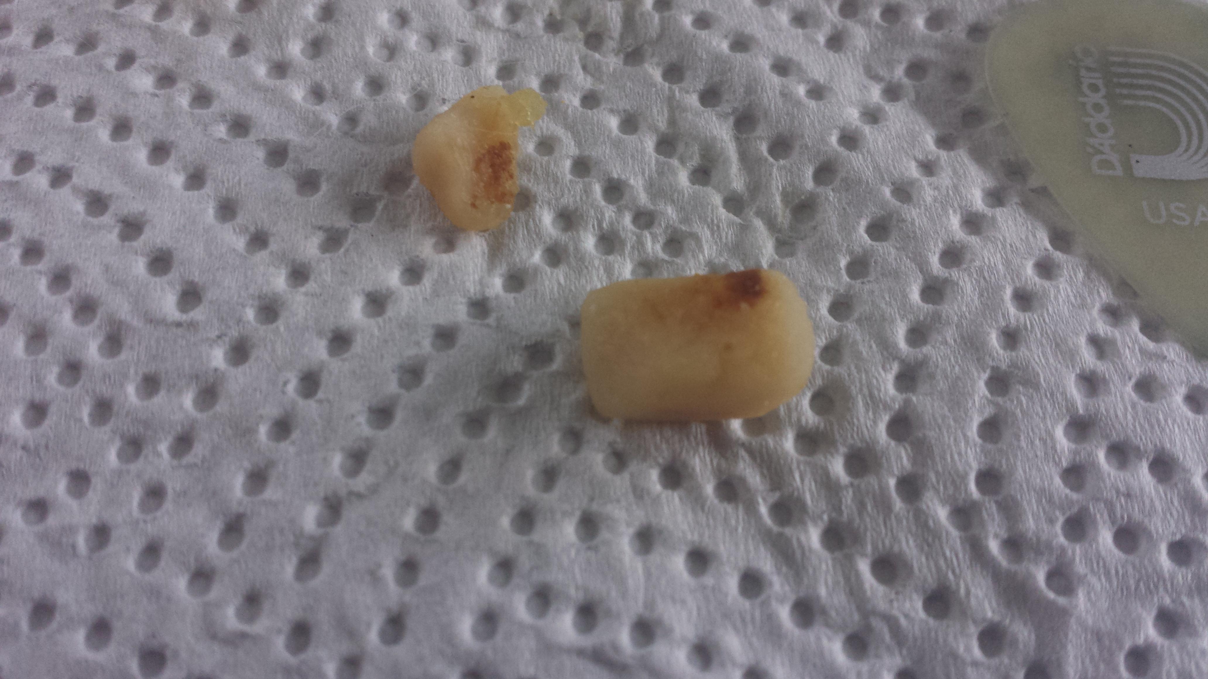 What is this rubbery toothlooking thing my dog vomited up? r