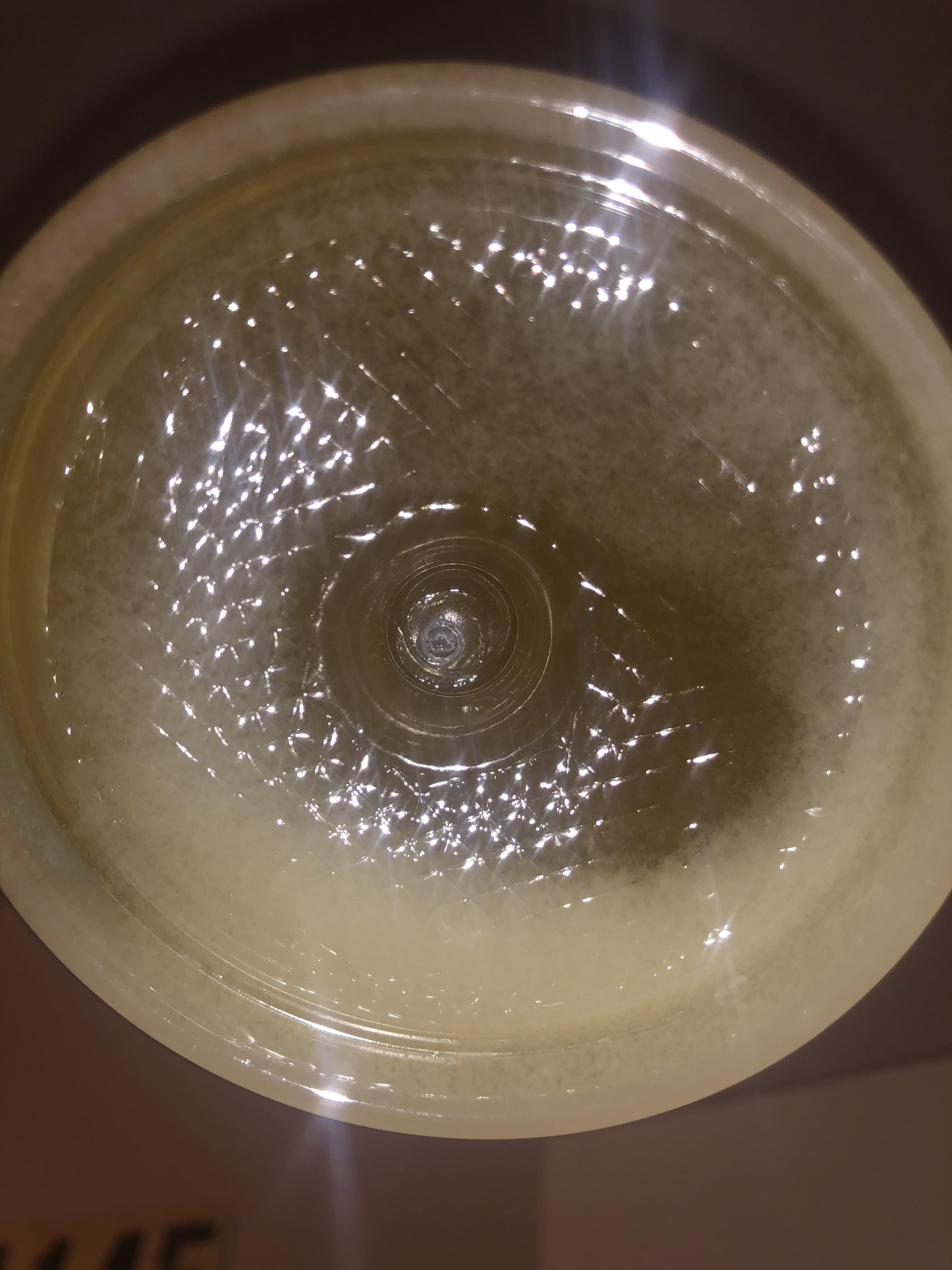 White sediment in urine, Back pain, and foamy urine please help