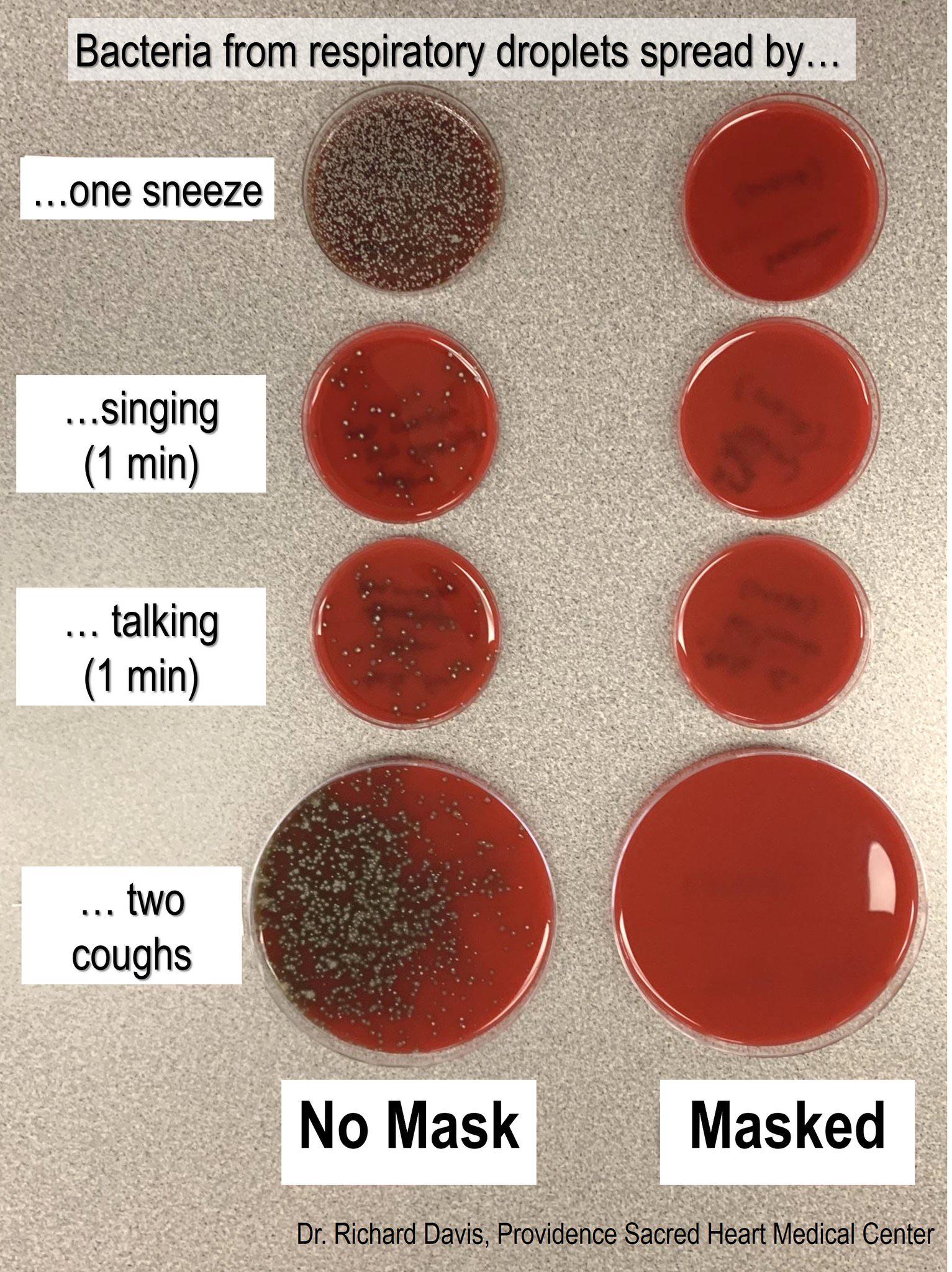 A doctor sneezed, sang, talked & coughed toward an agar culture plate