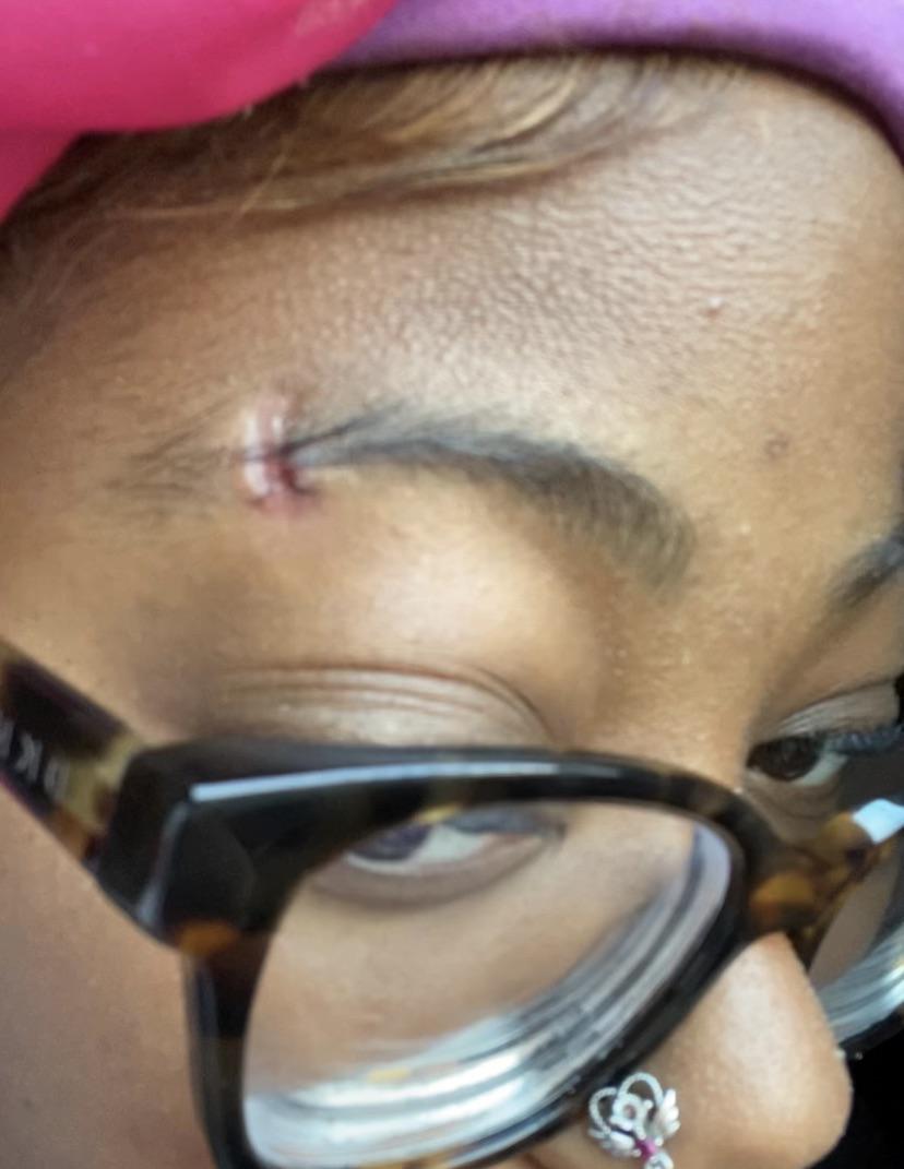 my entire eyebrow piercing randomly fell out today after 1 year! it