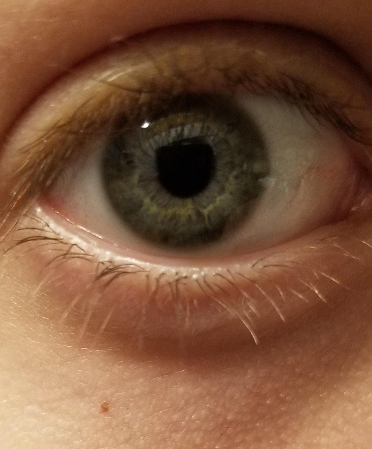 My gelatinous marble 👀 r/eyes