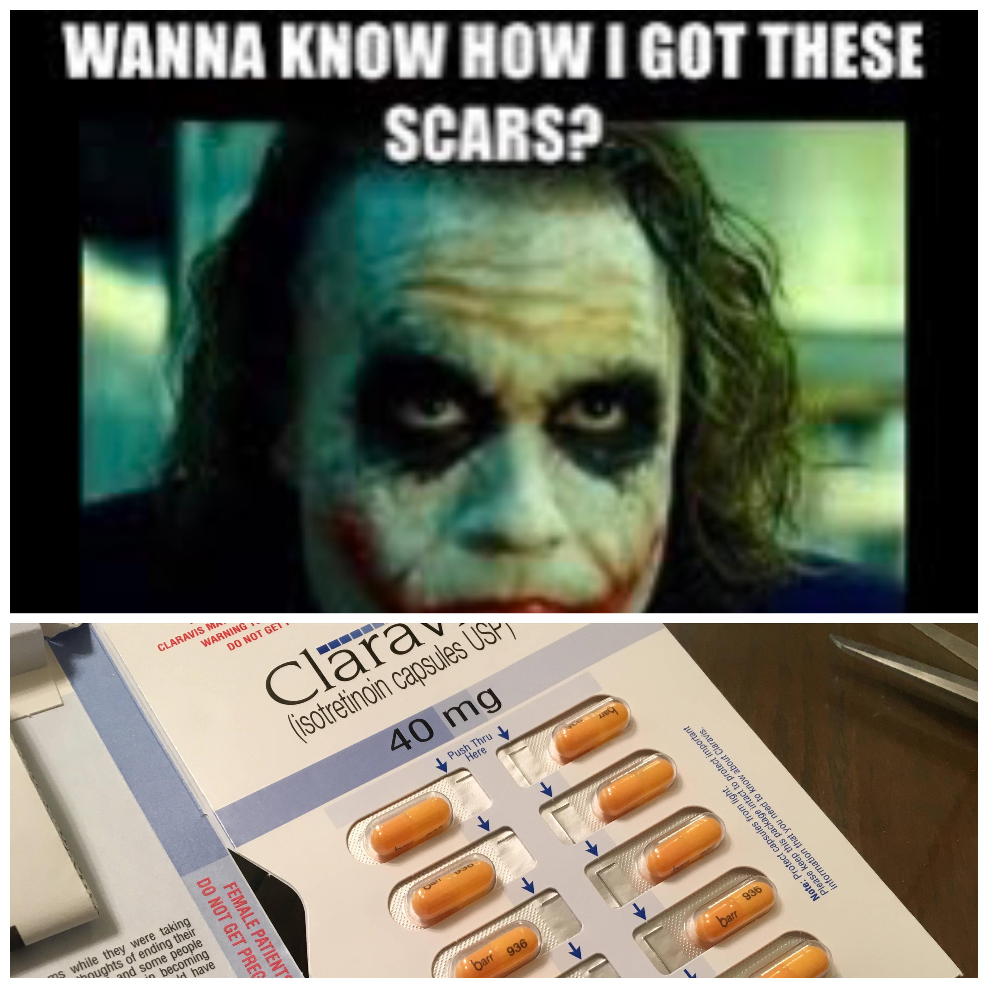 When the corners of your mouth start cracking and splitting r/Accutane