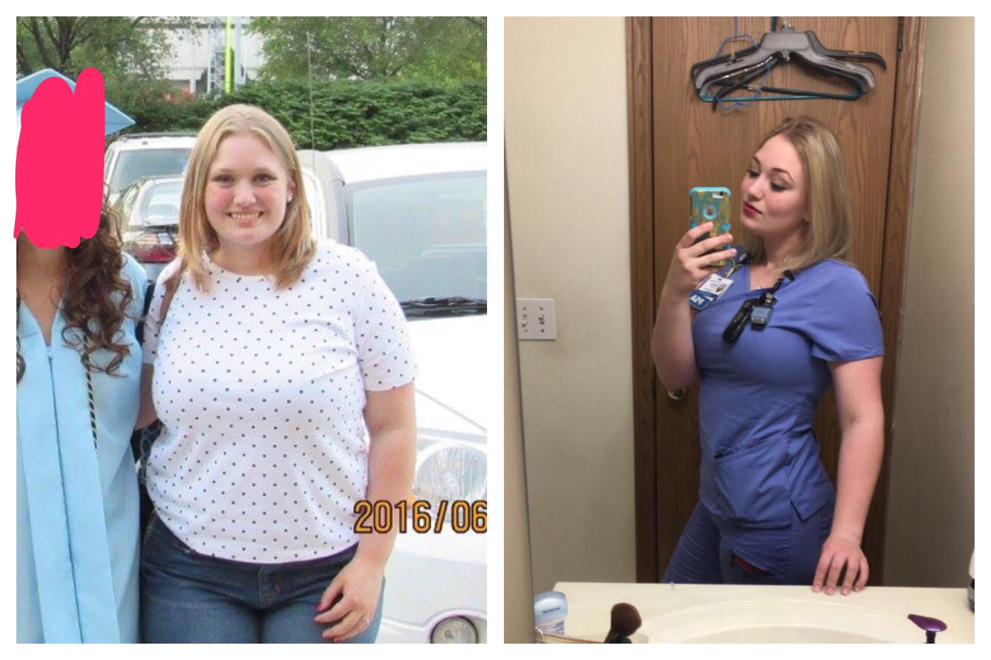 F/20/5'2" [197lbs > 147lbs = 50lbs] (1 year) One year ago, I had no