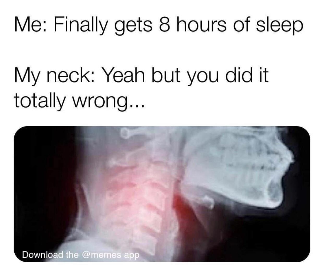 1302 best r/migraine images on Pholder I got too much sleep or maybe