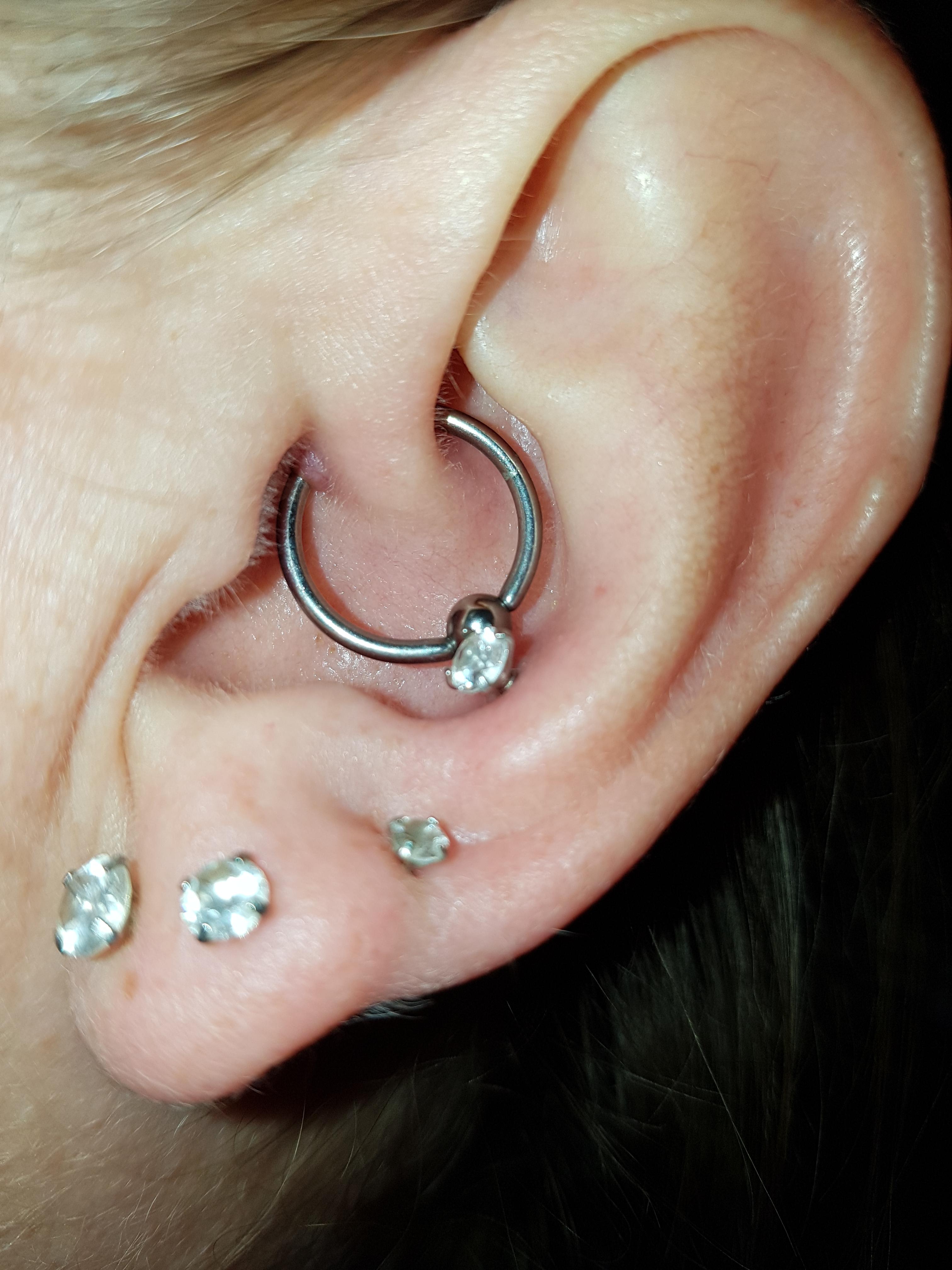 Daith piercing bump advice please. Details in the comments. piercing