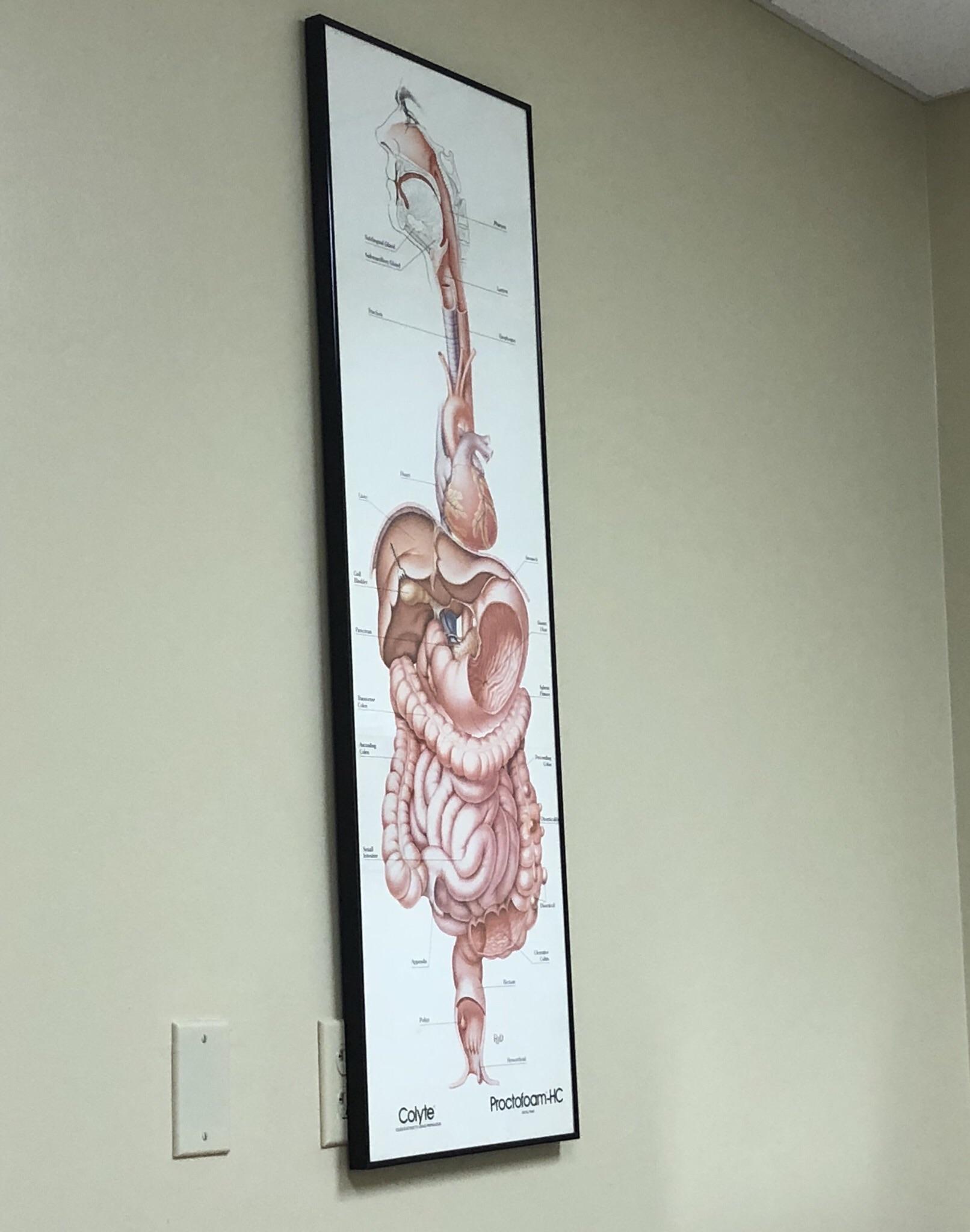 The way this diagram was hung on the wall r/mildlyinfuriating