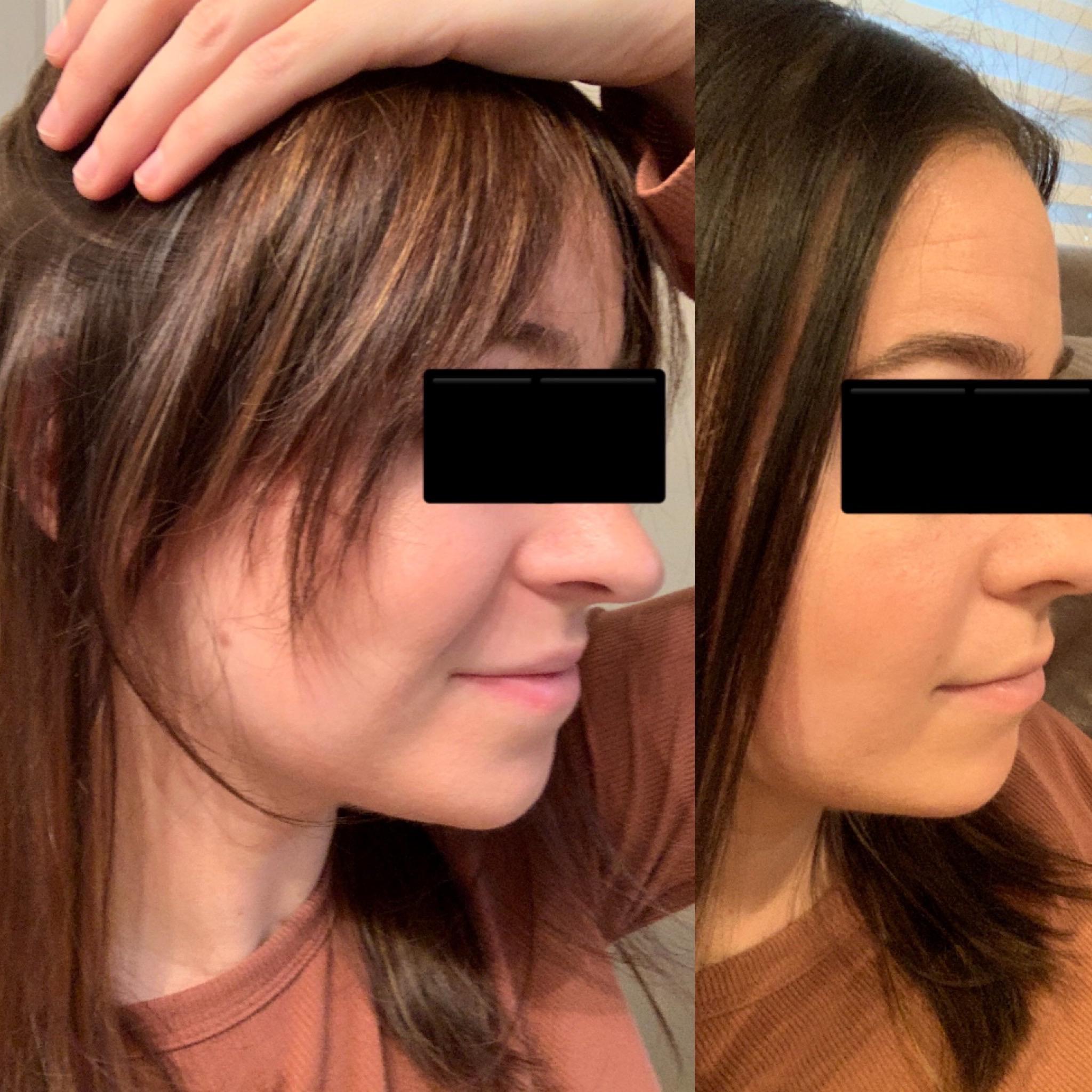 Curtain bangs, yes or no? r/femalehairadvice