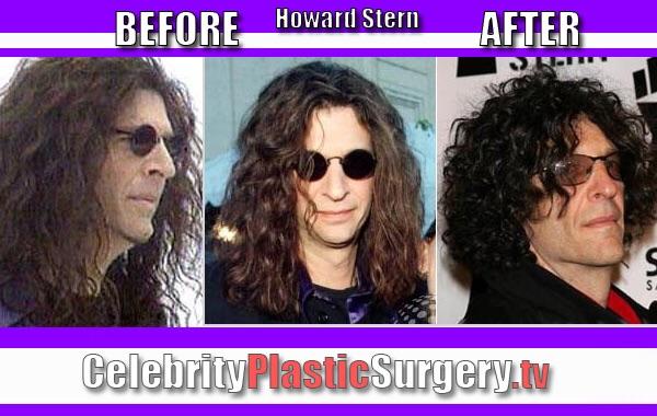 Plastic Surgery - Nah, Too Much Is A Puss To Go Under The Knife. Wig - Don't Think So. Hair Dyed - 100% Guaranteed : R/Howardstern