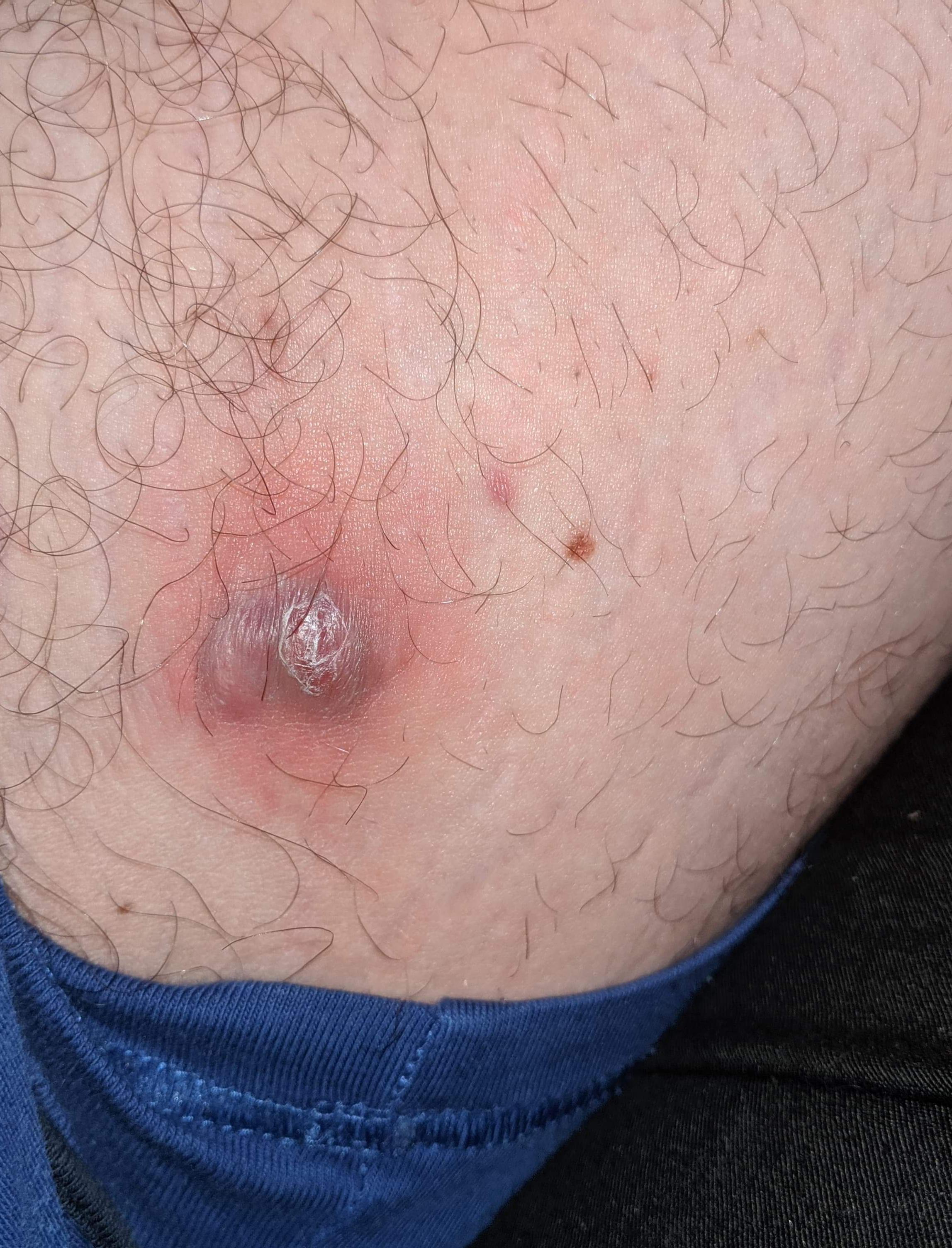 X Posting from Popping! Wondering if anyone can enlighten as to what