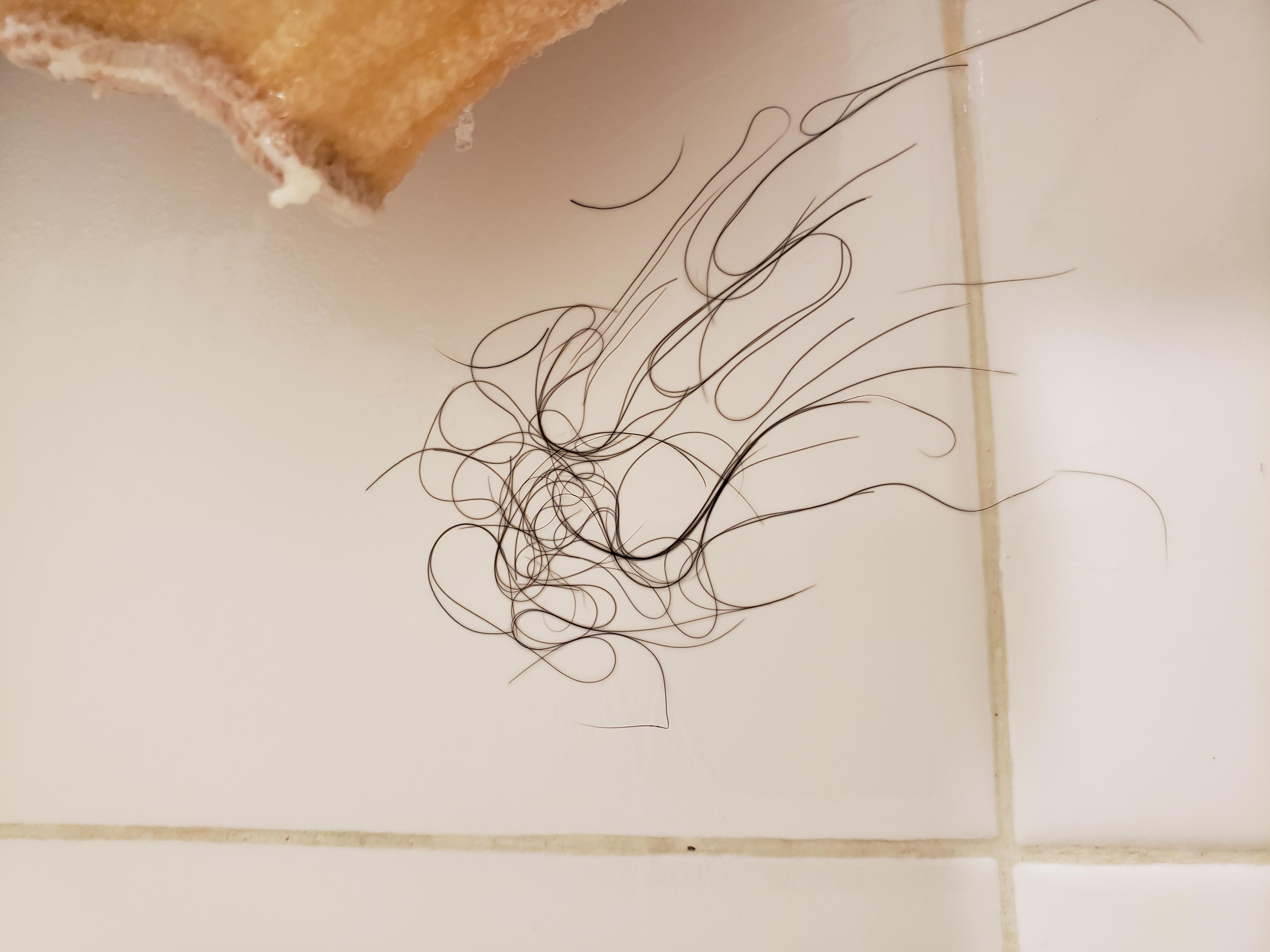 Is this much hair loss in the shower normal? r/tressless