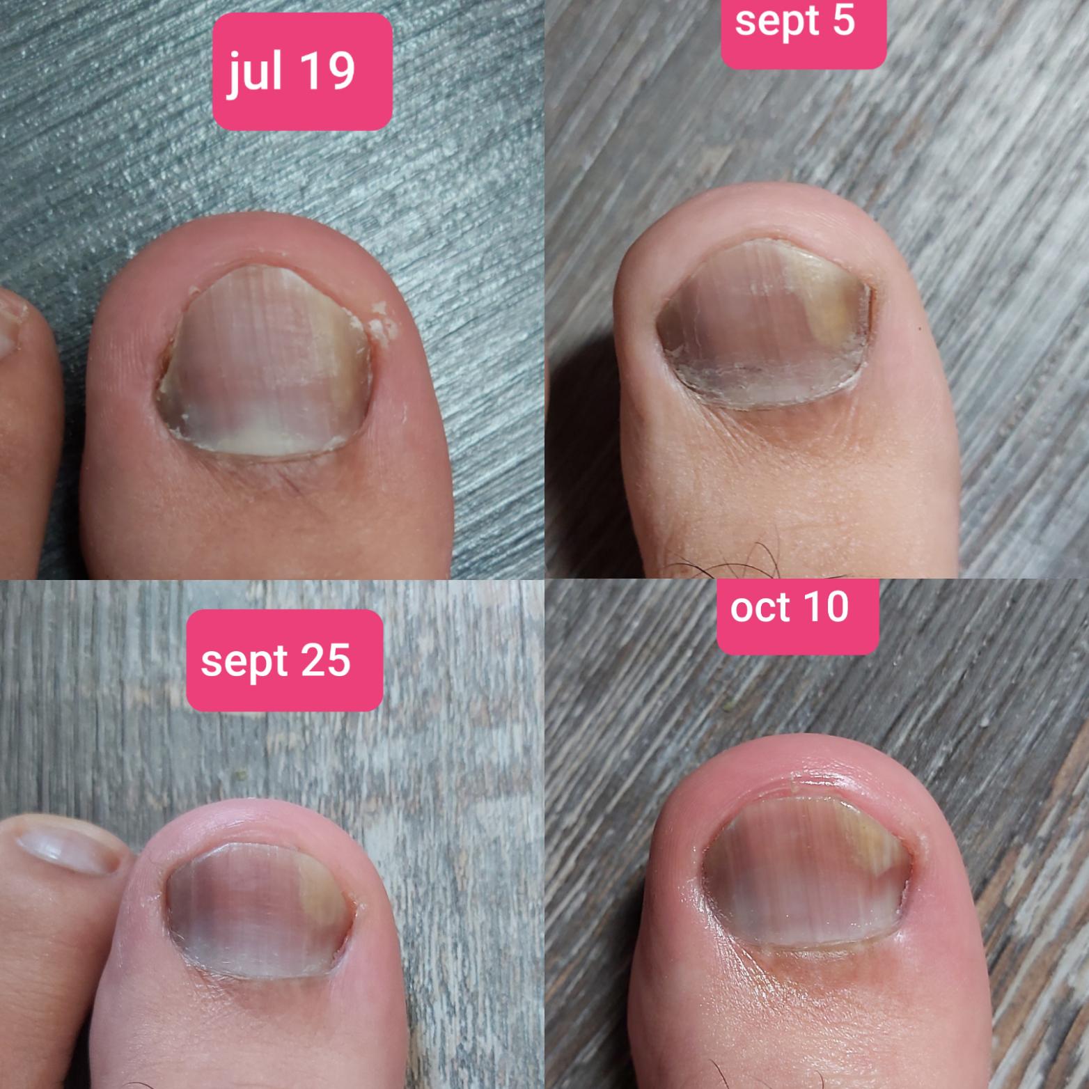 An update since I started Jublia on July 19. At first I didn't think it