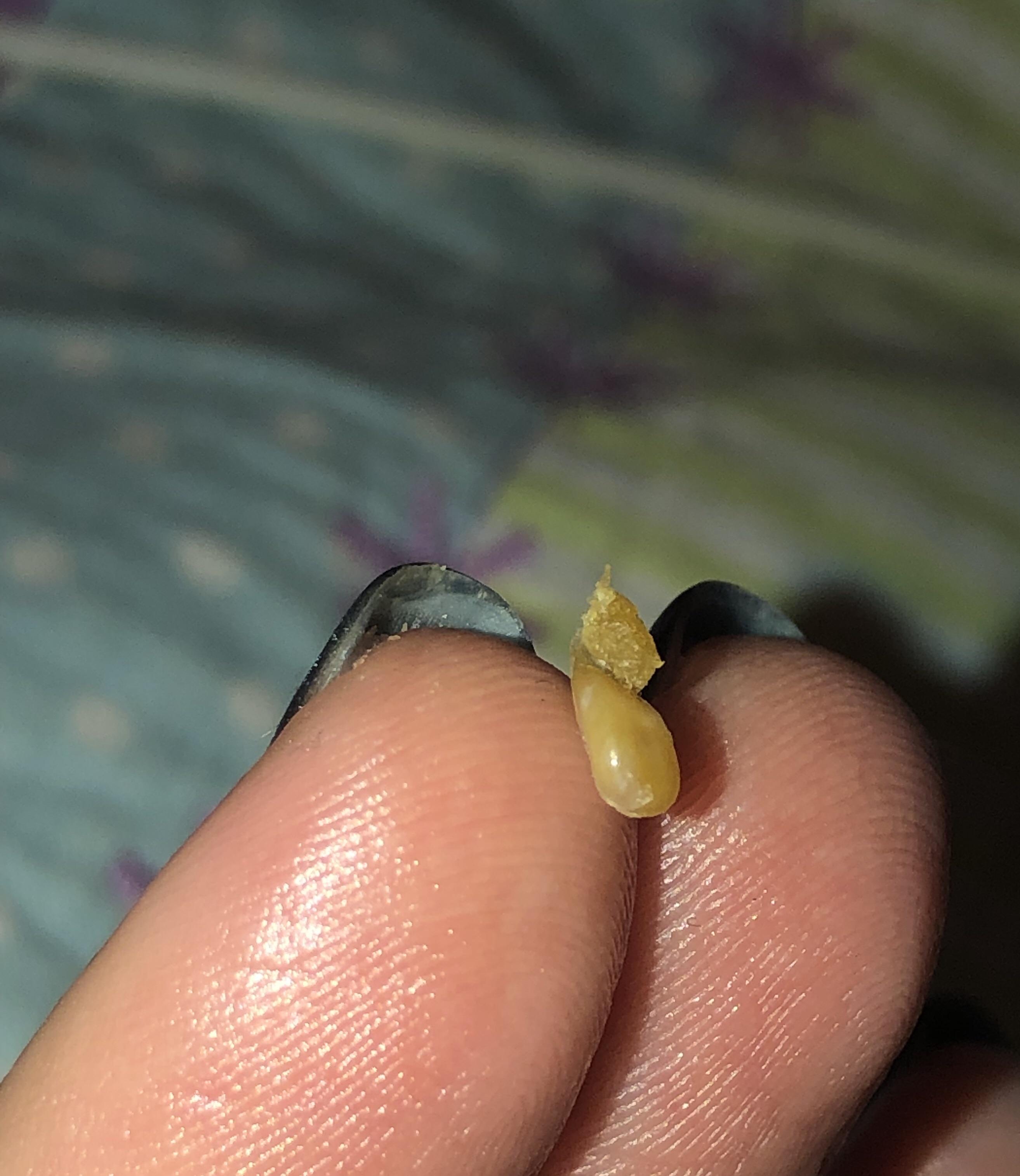 Scratched a bump inside my ear and this came out! popping