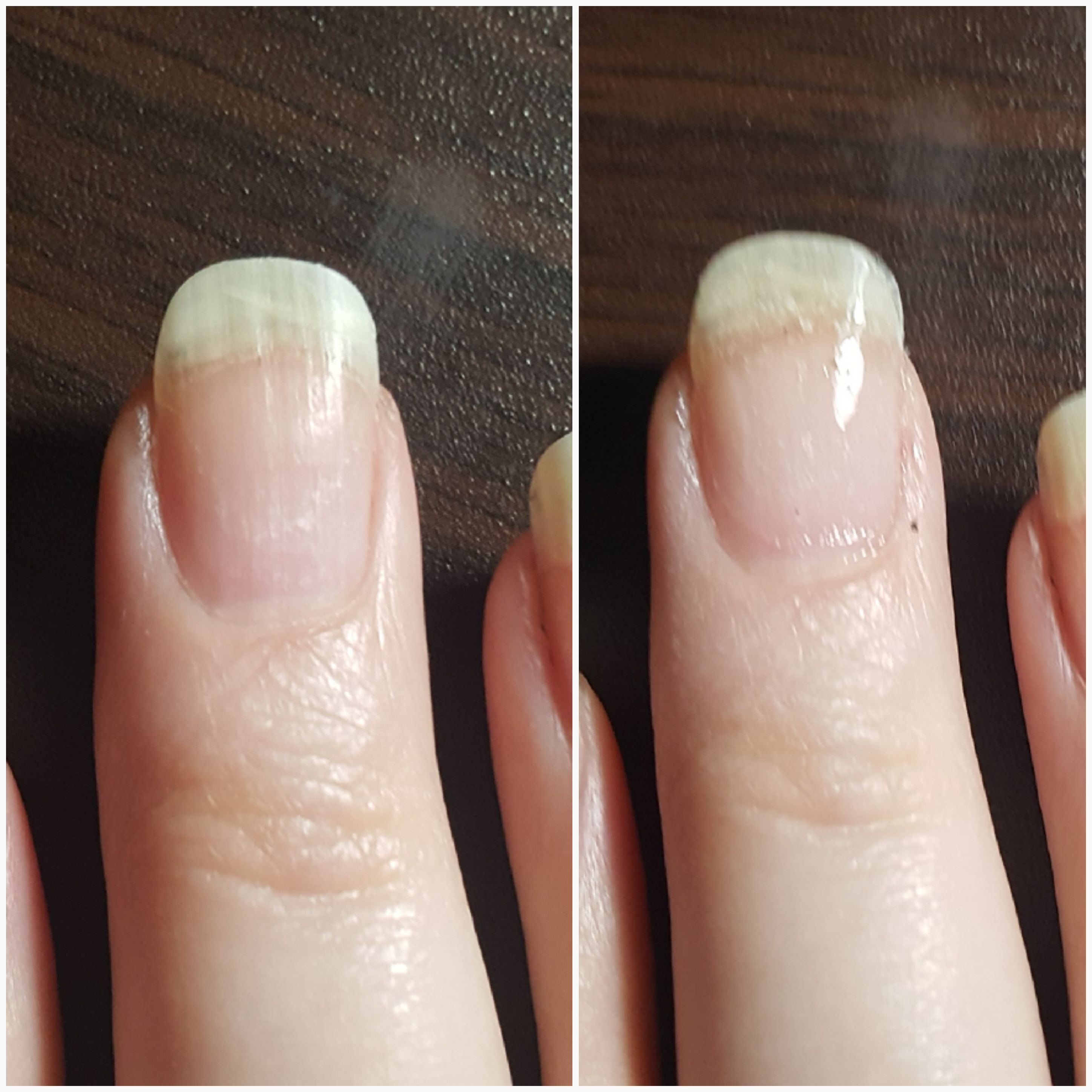 I broke a nail down below the quick a few weeks ago, and have had a lot