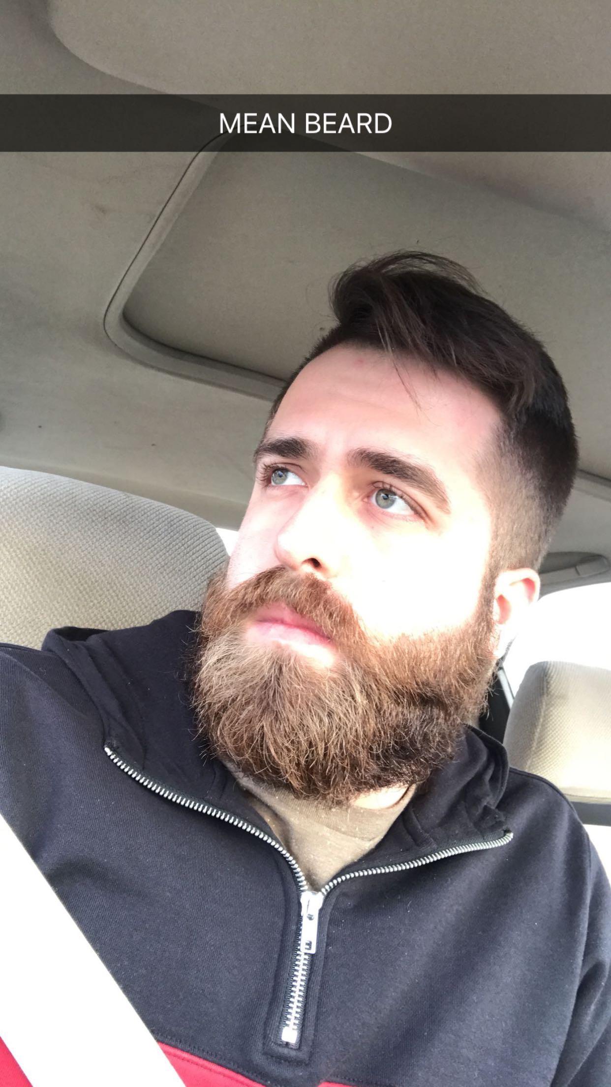 Sup guys! I’m having trouble with my beard. Mostly underneath my chin