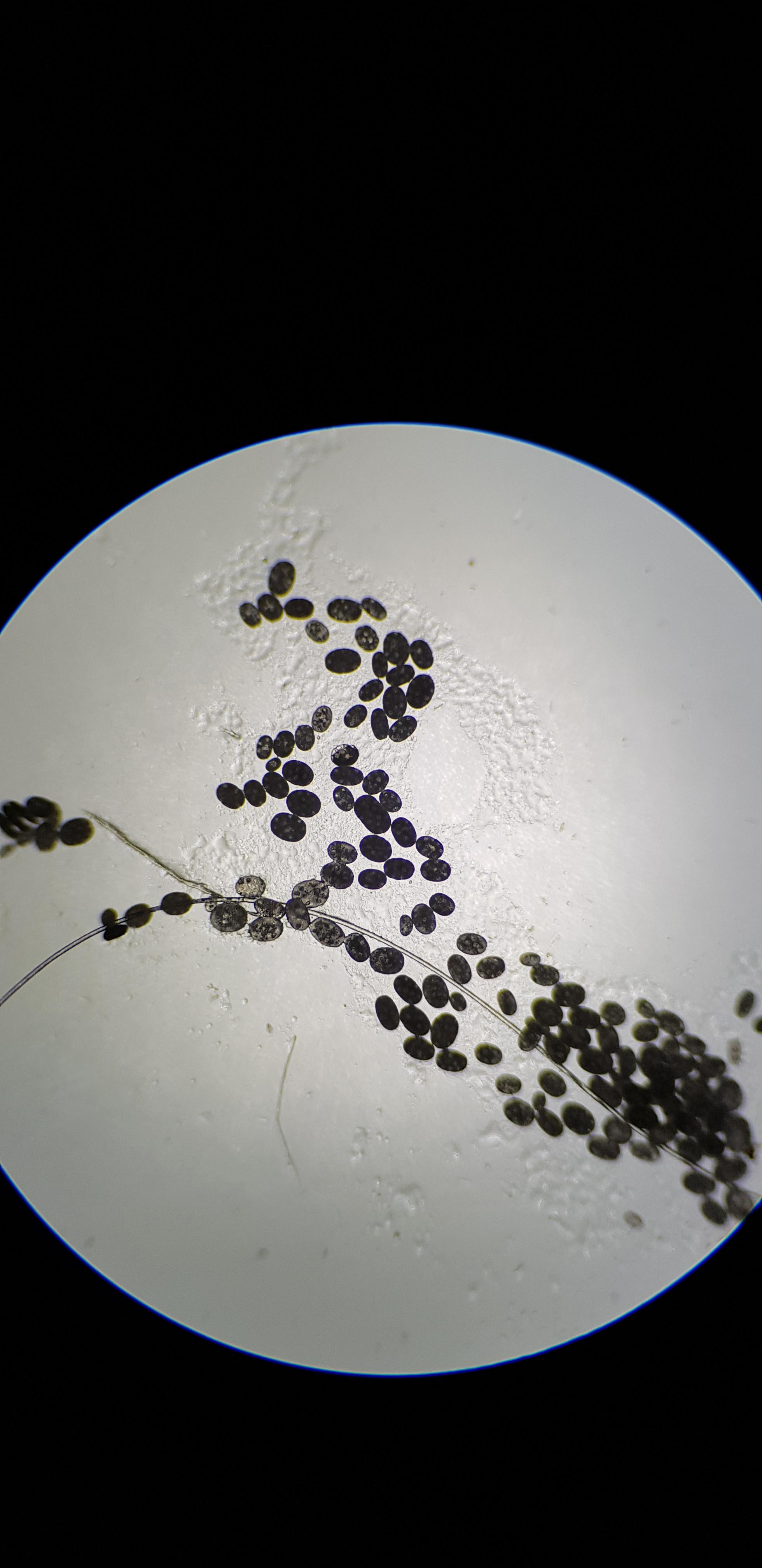 Roundworm eggs r/microscopy