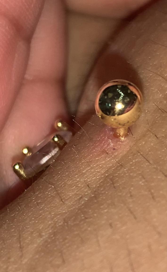 Got my navel pierced a week ago and I can’t tell if it’s rejecting or