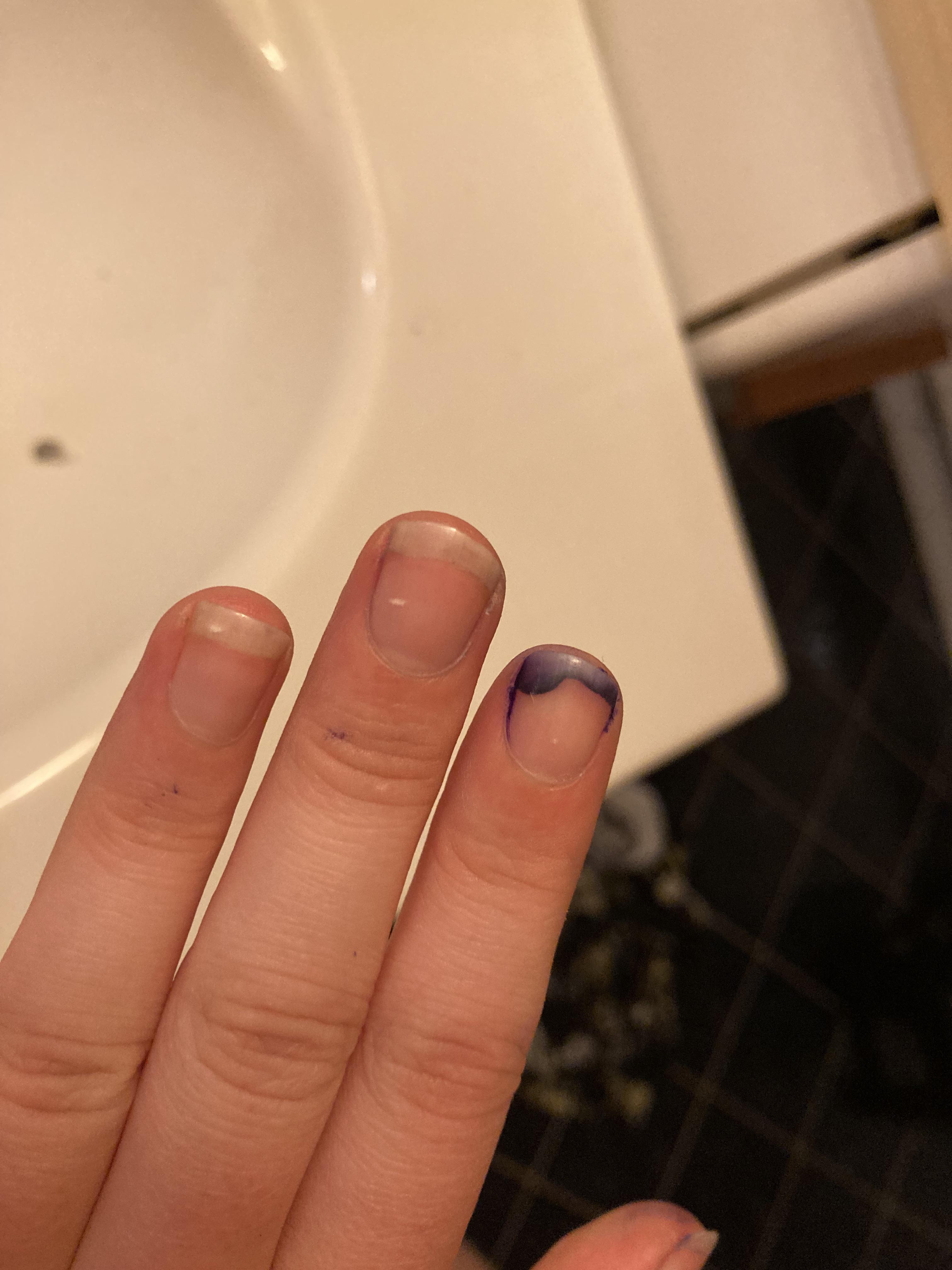 I got ink under my nail and it highlights my uneven nail bed r