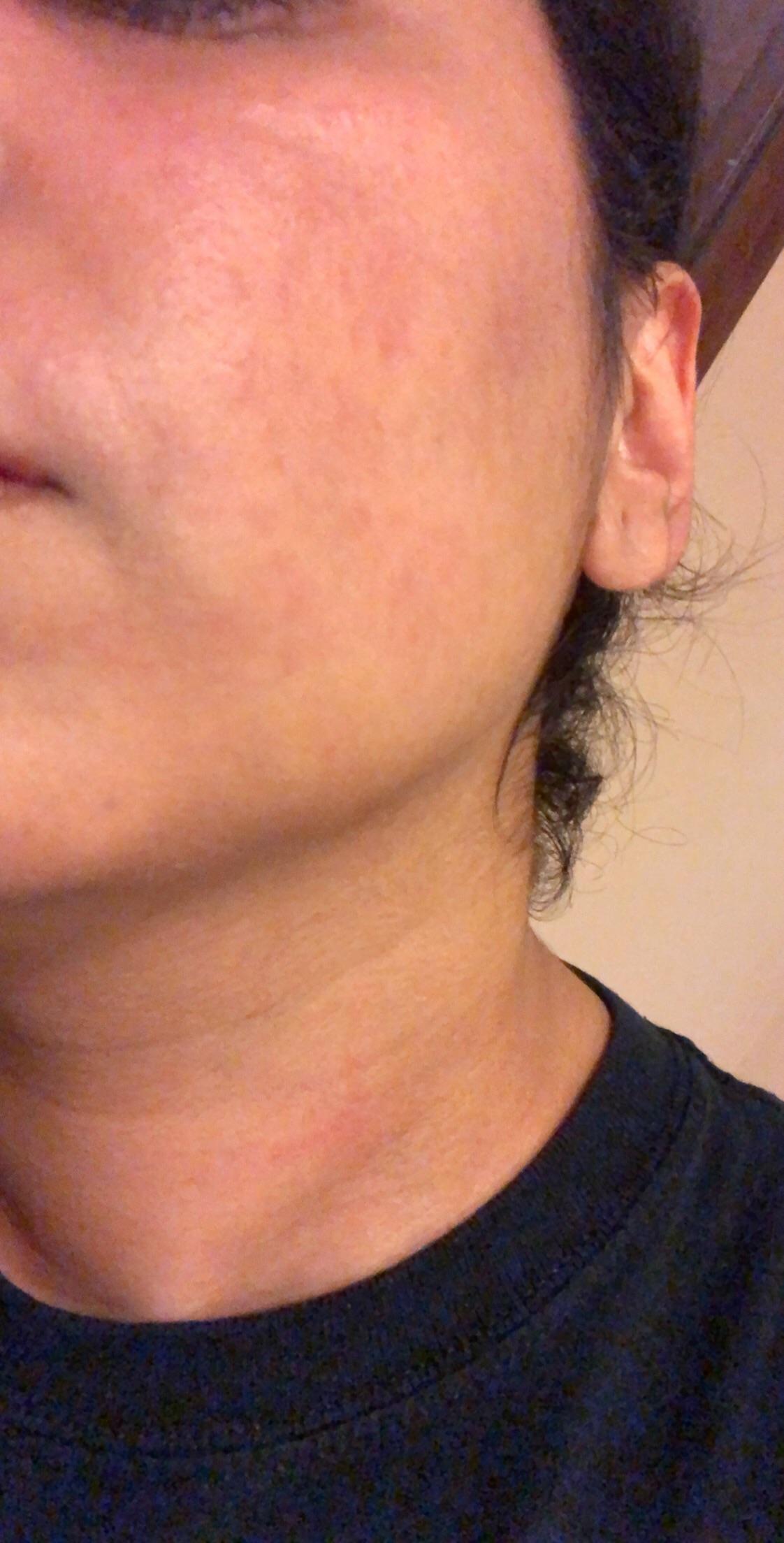 [skin concern] Cerave Facial Moisturizing Lotion PM Suddenly made my
