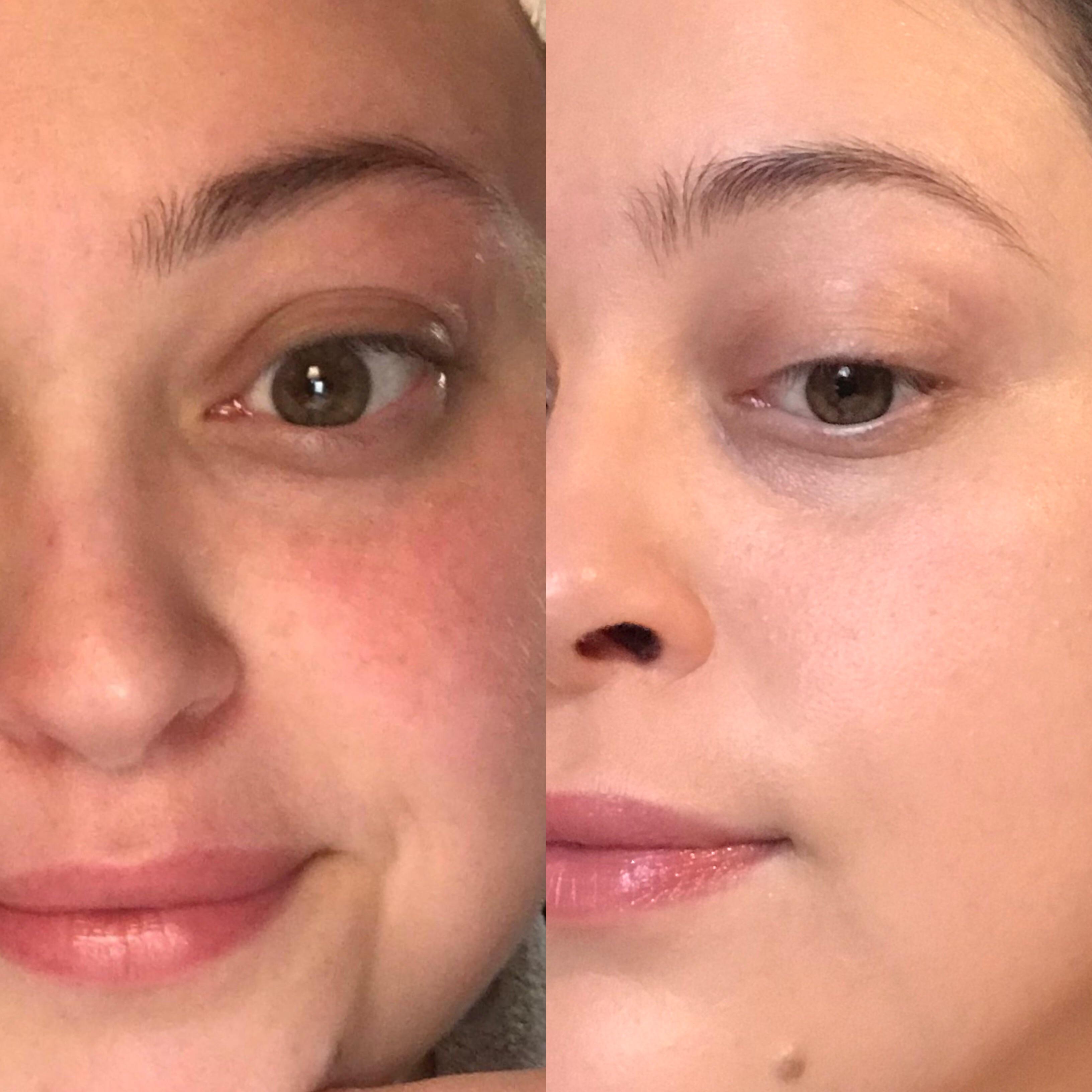 One layer of Neutrogena’s Hydro Boost Hydrating Tint r/MakeupAddiction