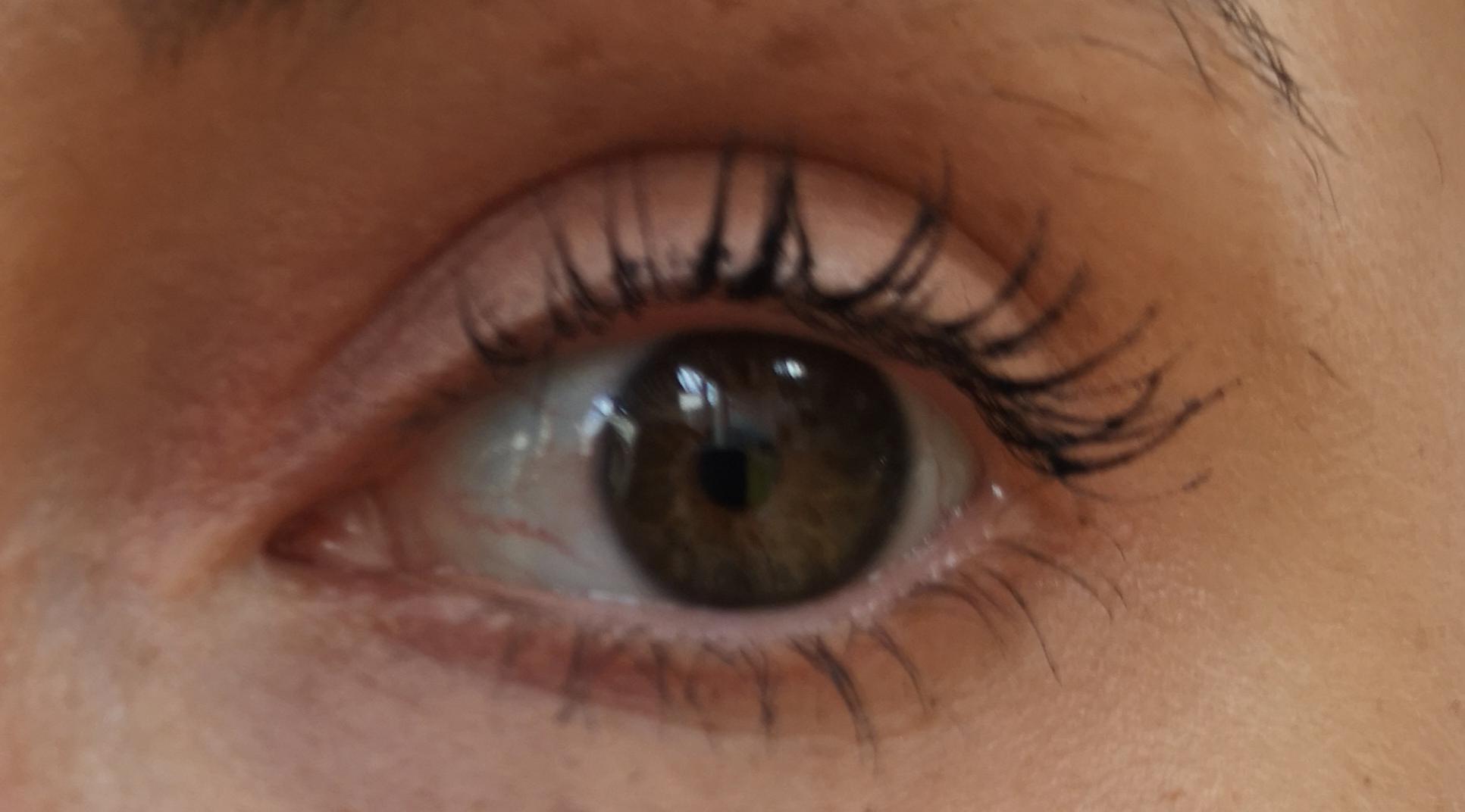 Iris dent r/optician