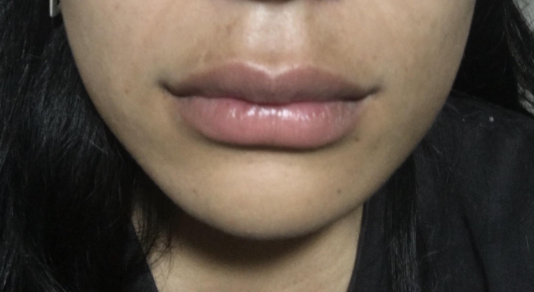 Any tips/product for reducing melasma/hyperpigmentation