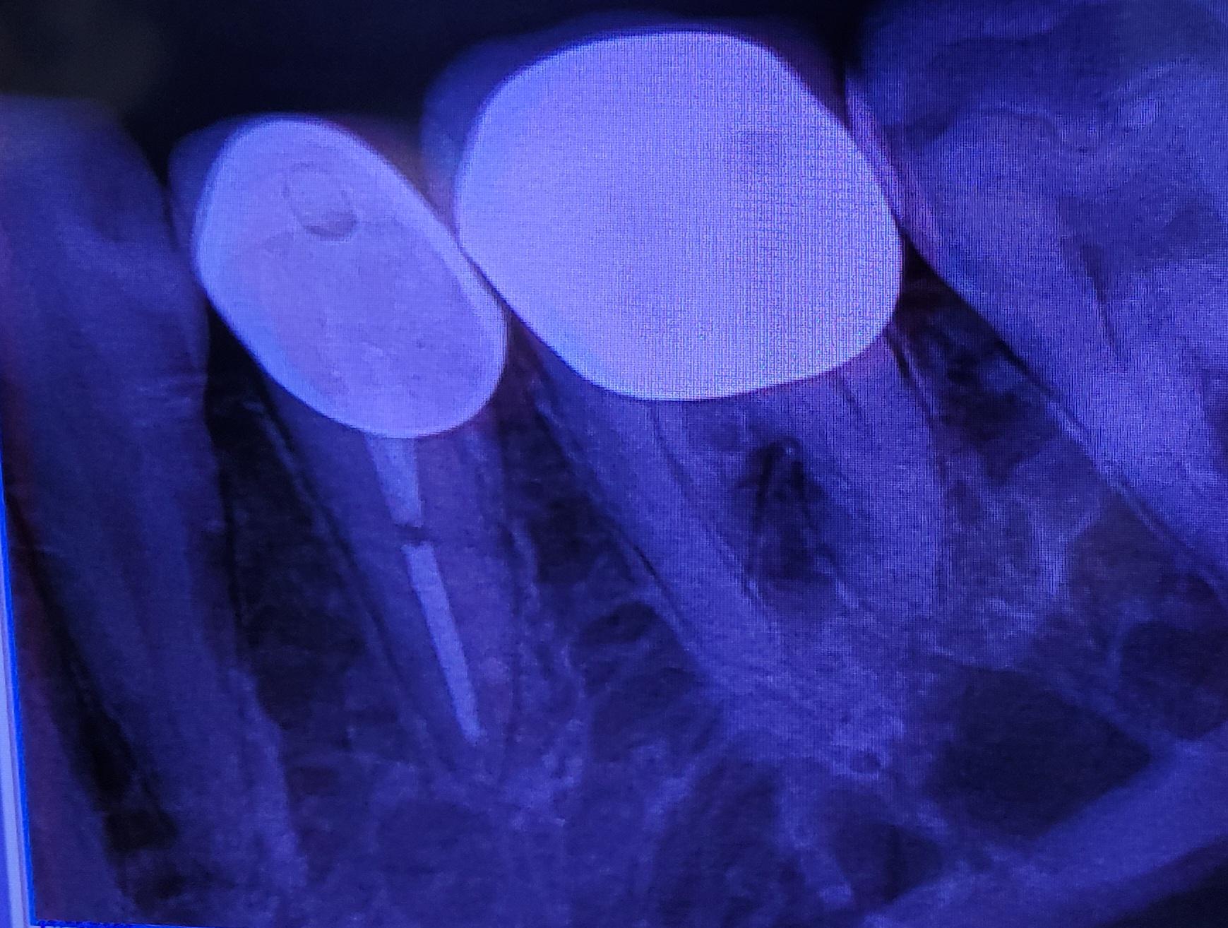 Can Endodontists diagnose trigeminal neuralgia? r/askdentists