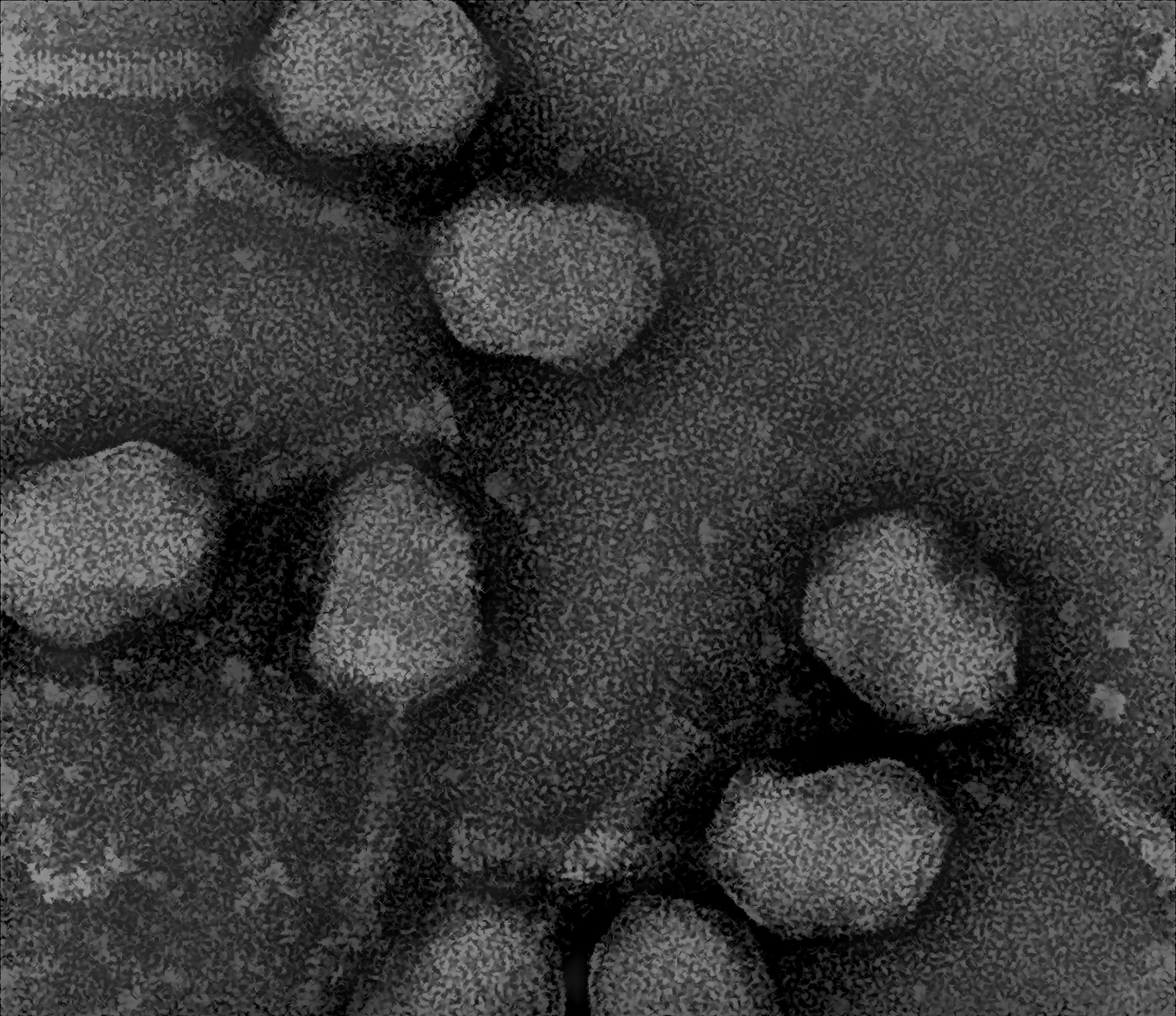 31 Hilarious Uranyl zinc acetate Puns Punstoppable 🛑
