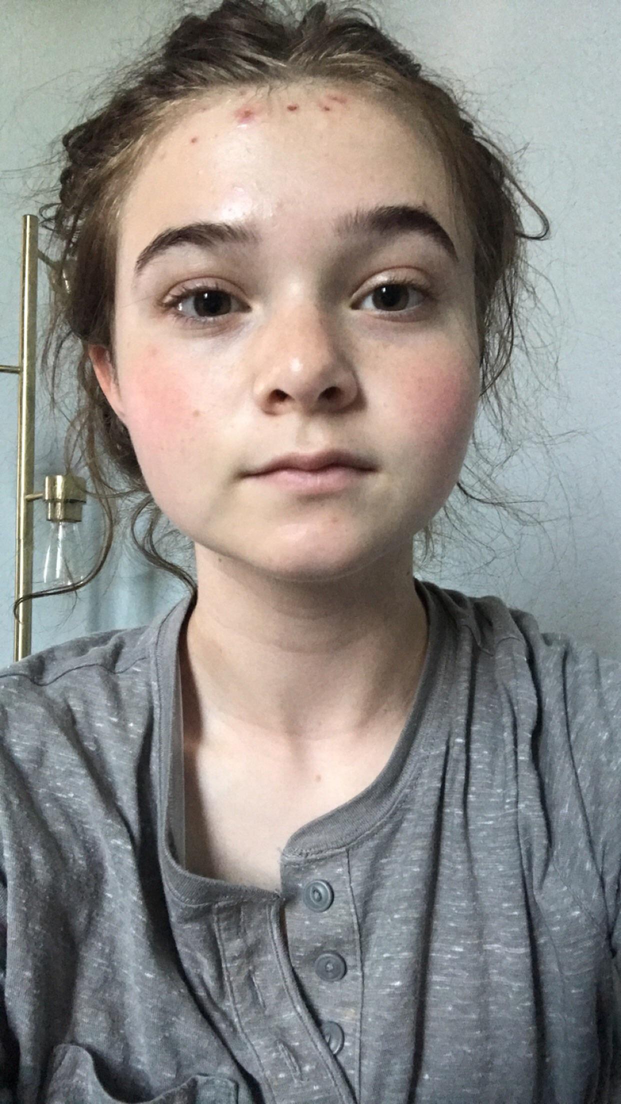 What kind of makeup will suit my face? Ignore my hairline, I had an