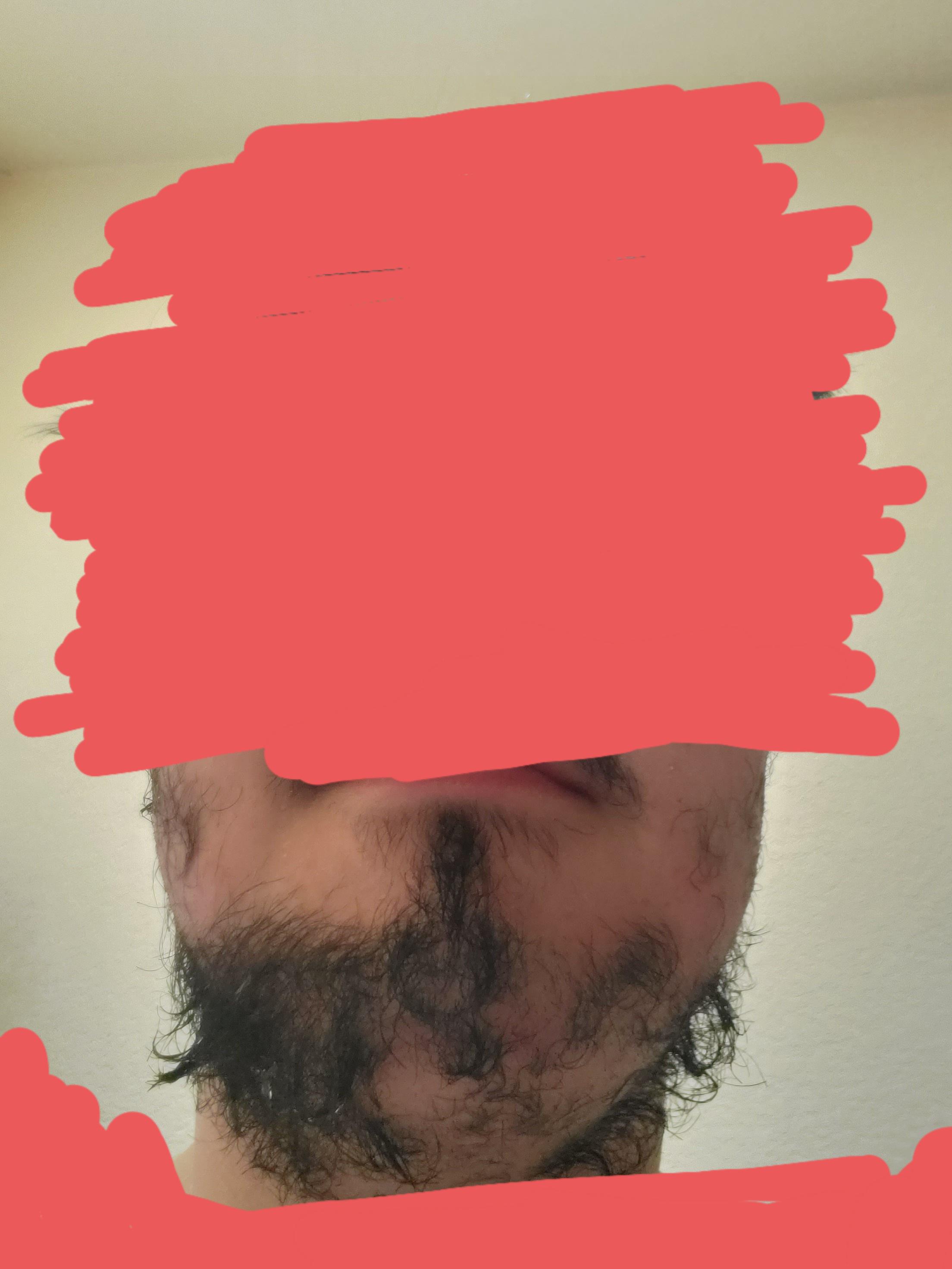 [Hair Gore] I recently used some magic shave powder on my beard (which
