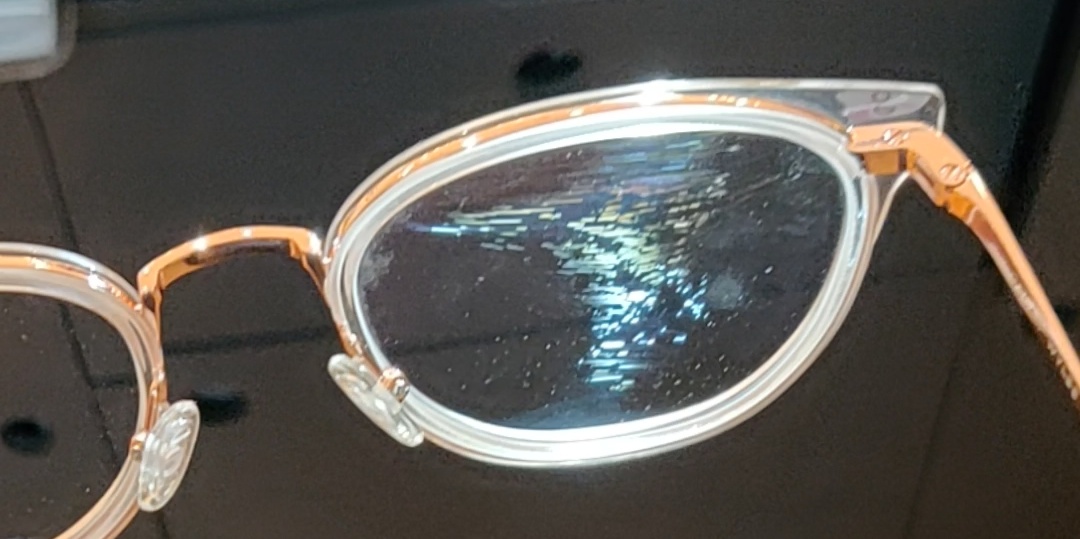 What causes internal lens defects? r/optometry