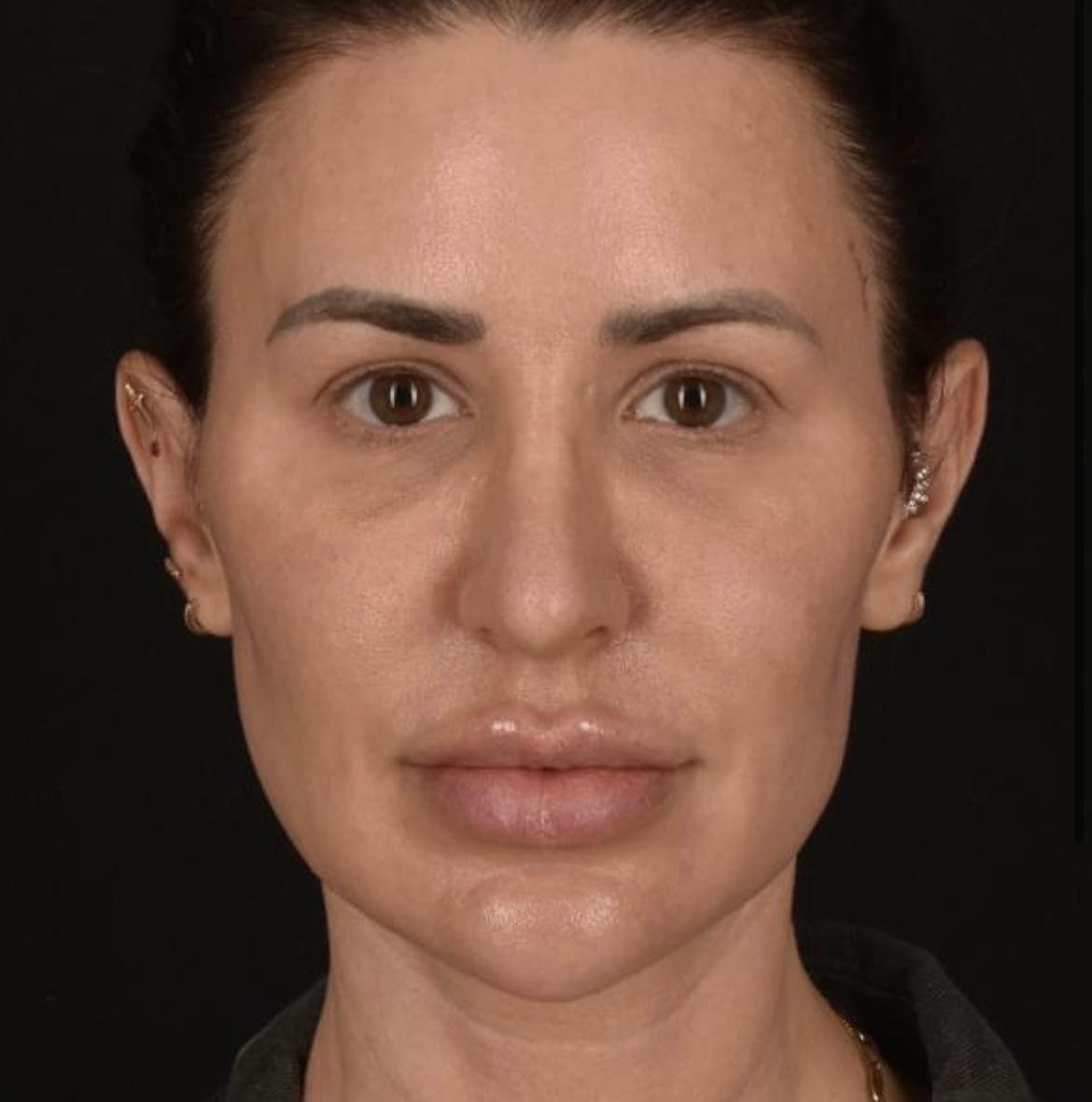 The only acceptable photo of Shekinah to post here : r