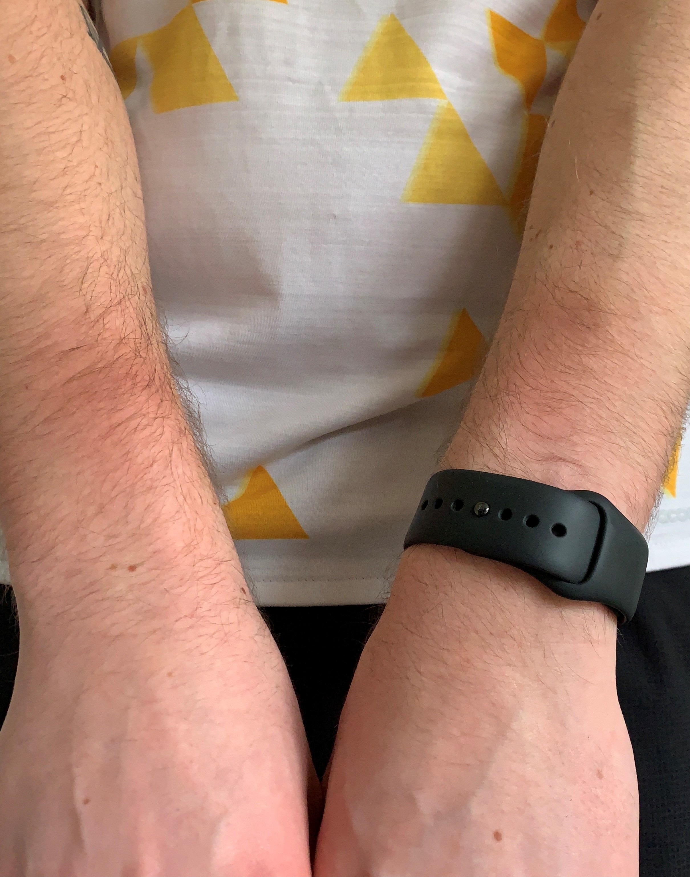 For the life of me I cannot get around the bruising and pain bells