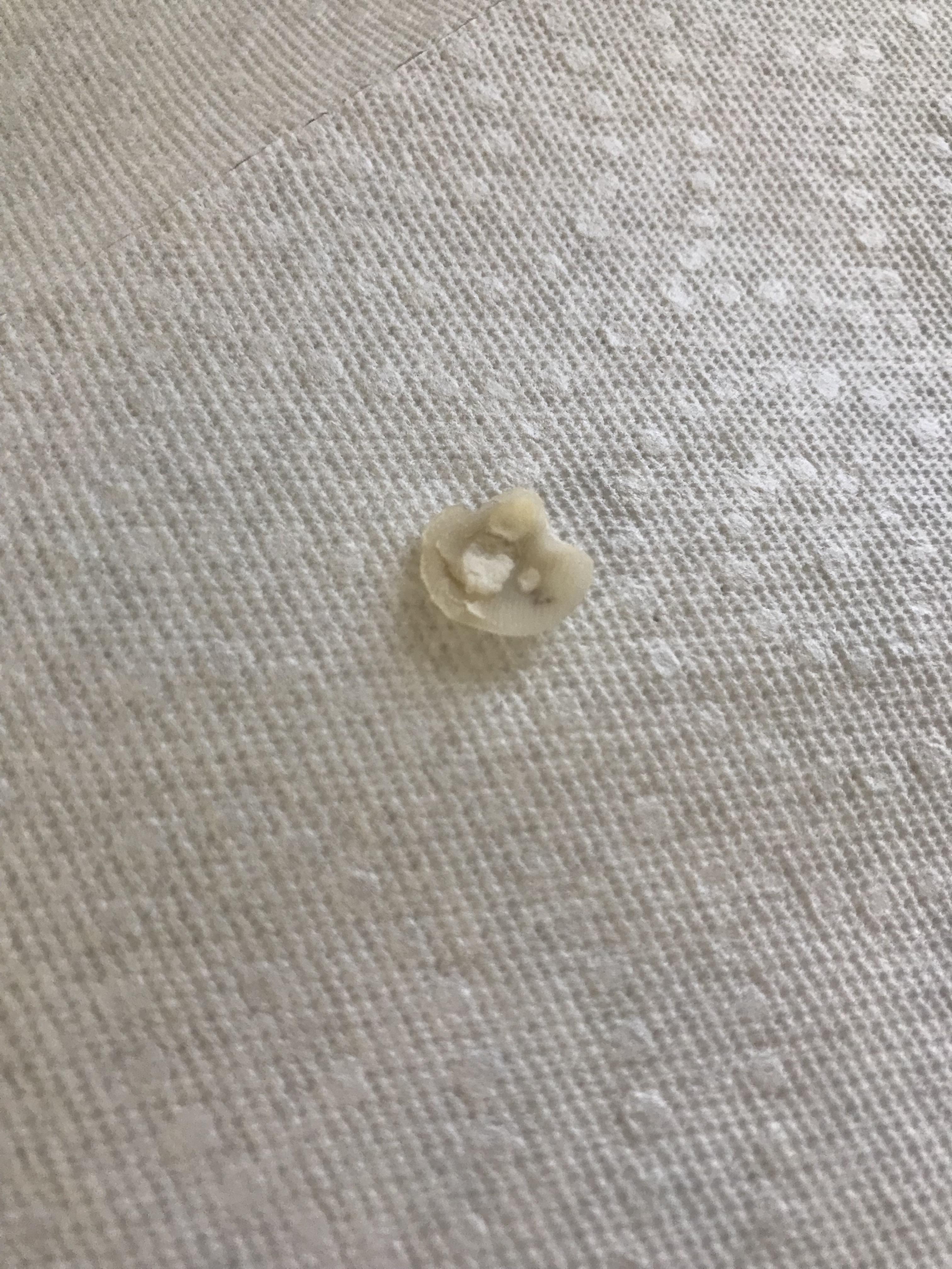 177 best Plantar Wart images on Pholder Warts, Peeling and Dermatology