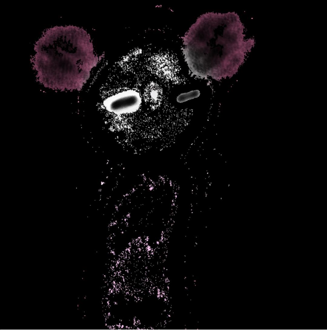 My balls hurt r/Apandah