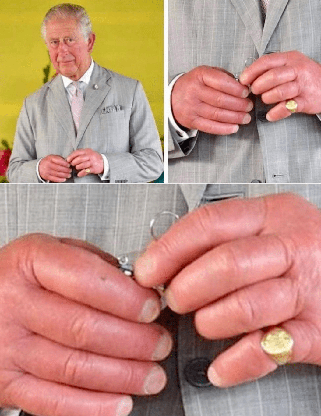 Fingers of Charles III, King of England. r/TerrifyingAsFuck