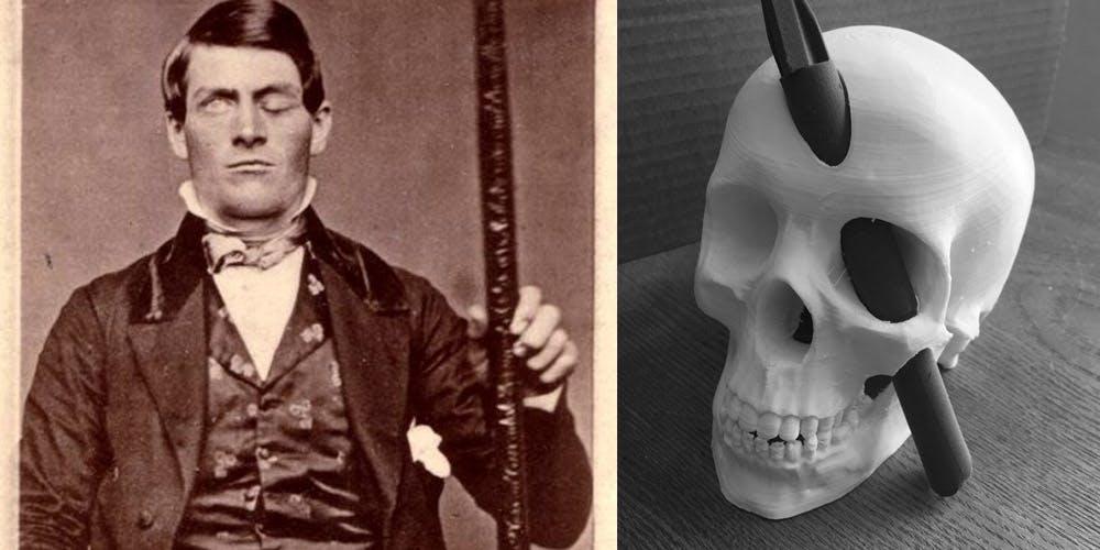 Meet Phineas Gage. The railroad worker who survived an iron rod going