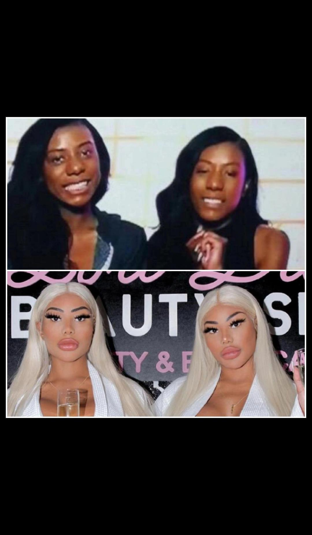 Clermont Twins BEFORE +AFTER 🤯