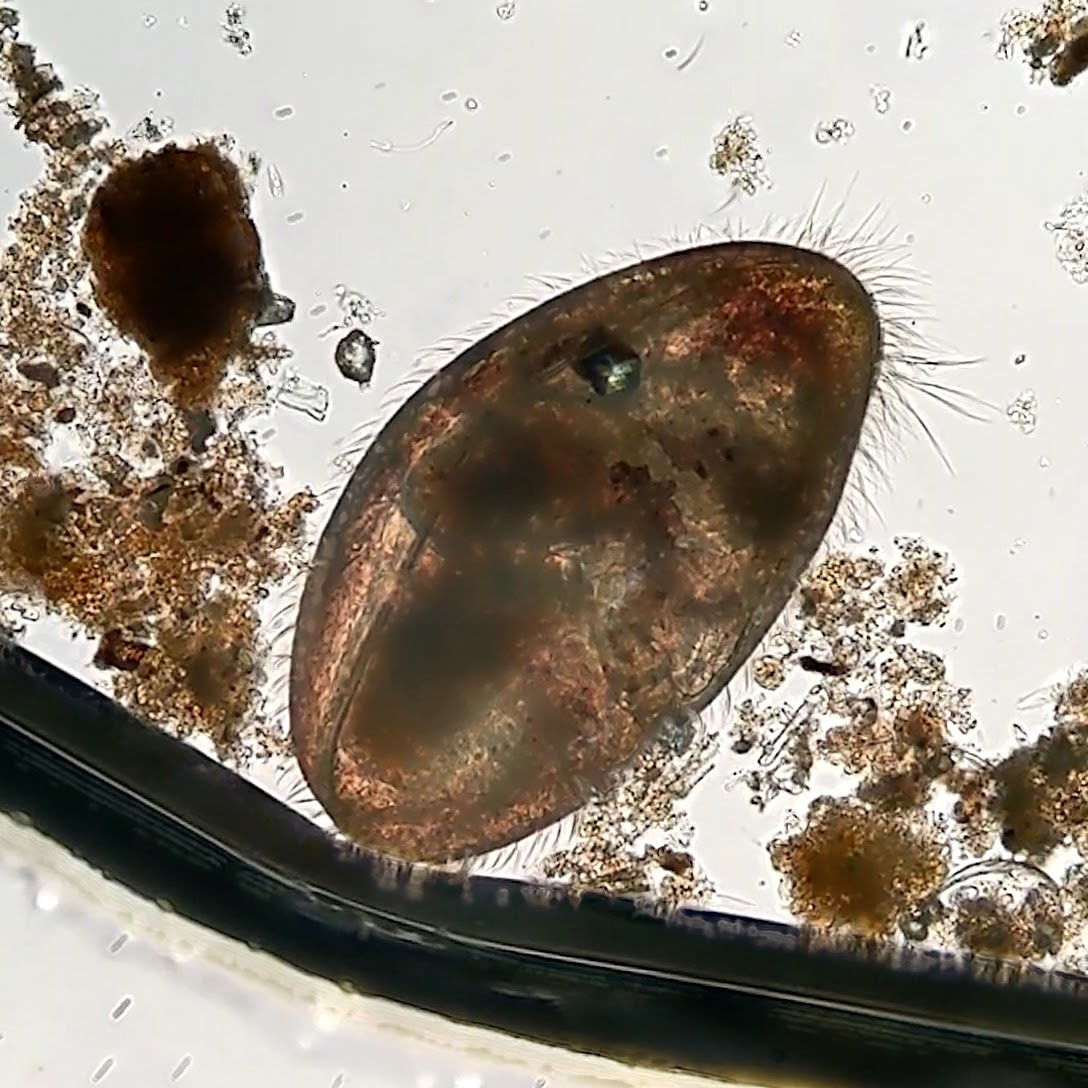 Ostracod close up r/Ecosphere
