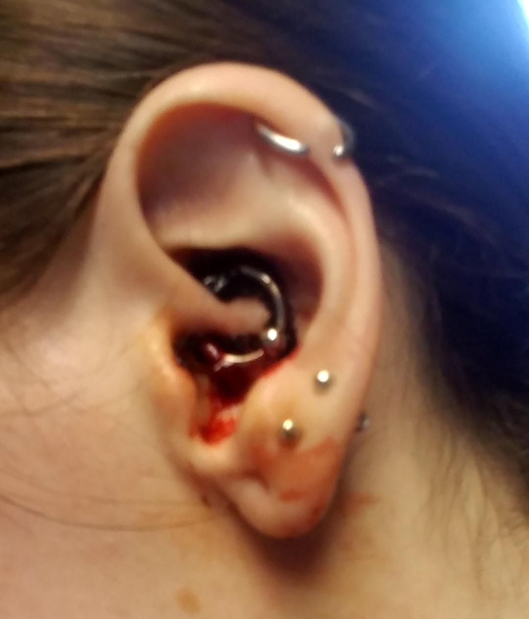Help! 3 day old Daith. How much bleeding is normal? piercing