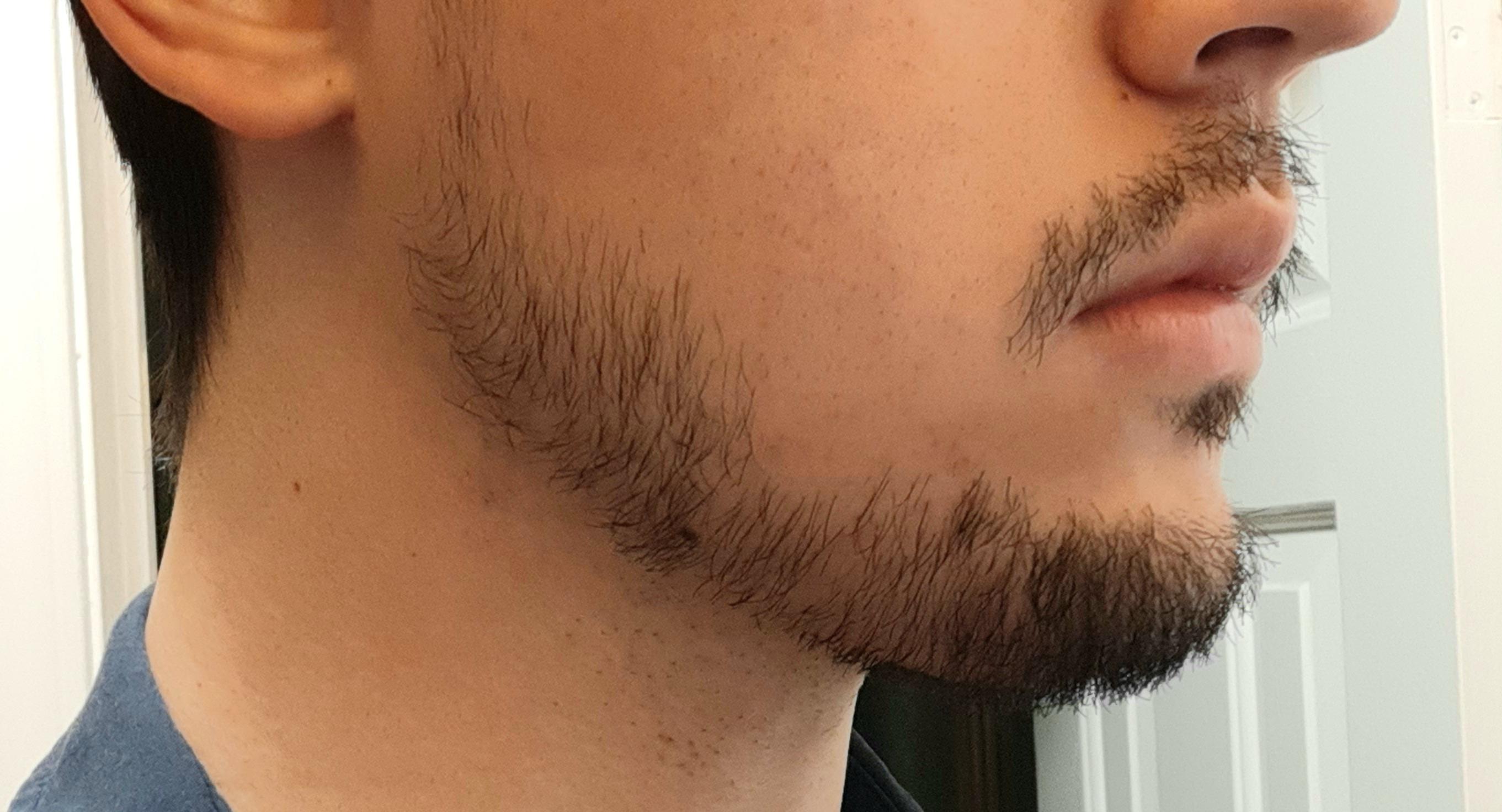 Does the short facial hair work or should I just shave it? I'm 27M and