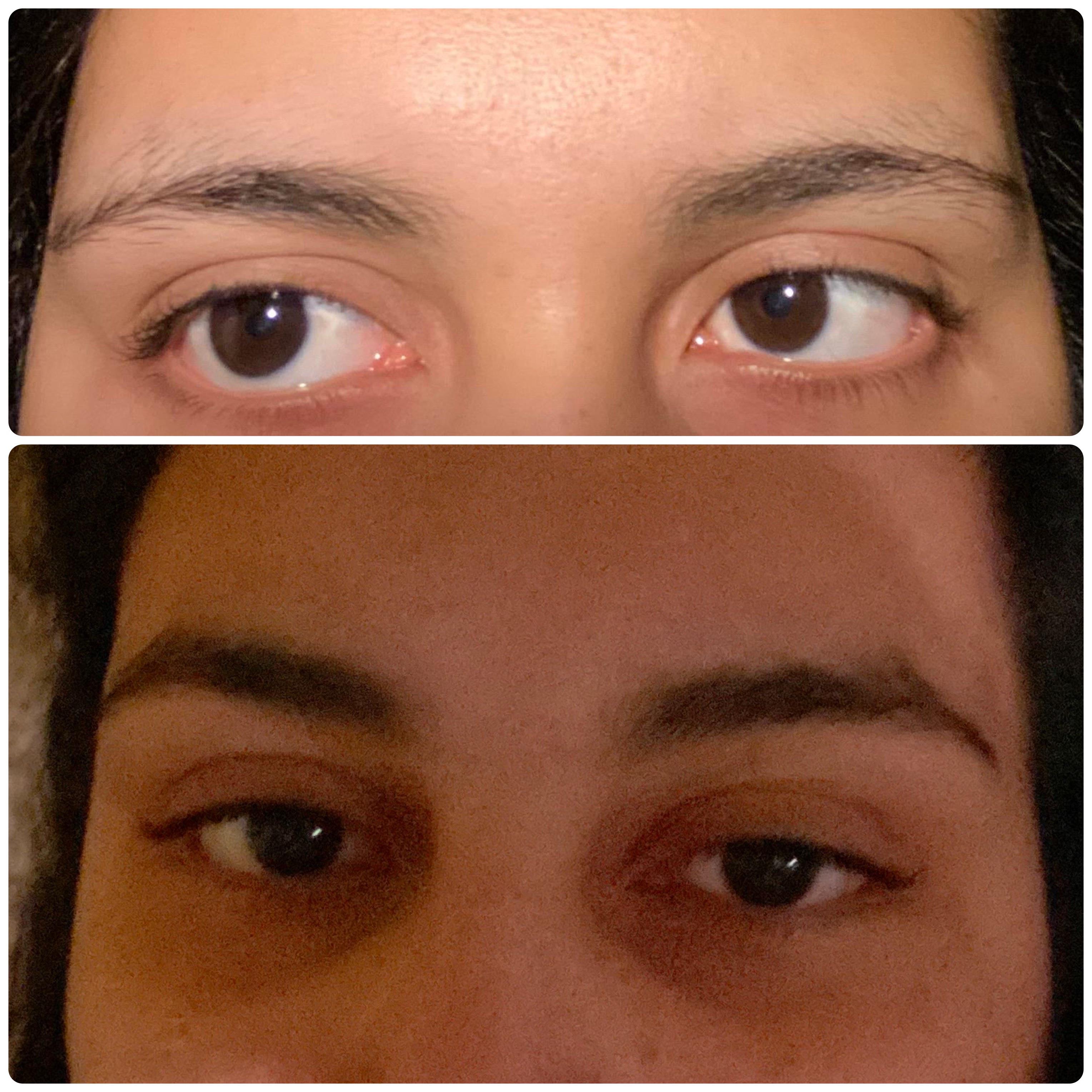 So I took the comments advice and grew out my eyebrows. Huge difference