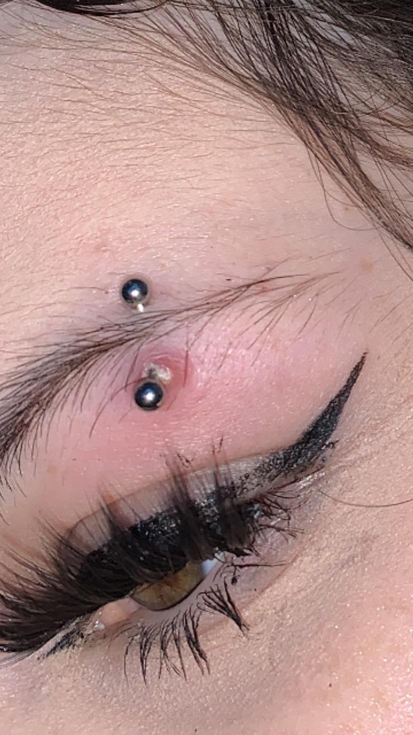 infected piercing how do i treat this r/piercing